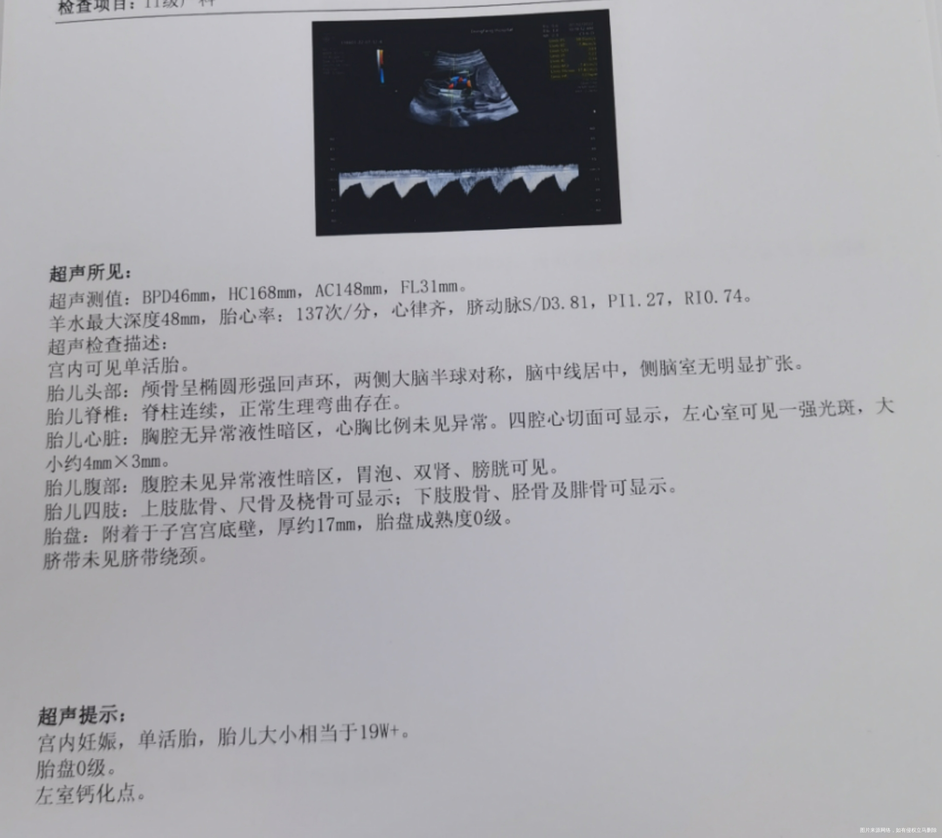 医生您好麻烦帮我这种情况严不严重下一步该怎么