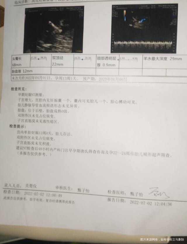 4月19日移植孕周12+5天今天做了NT只挂