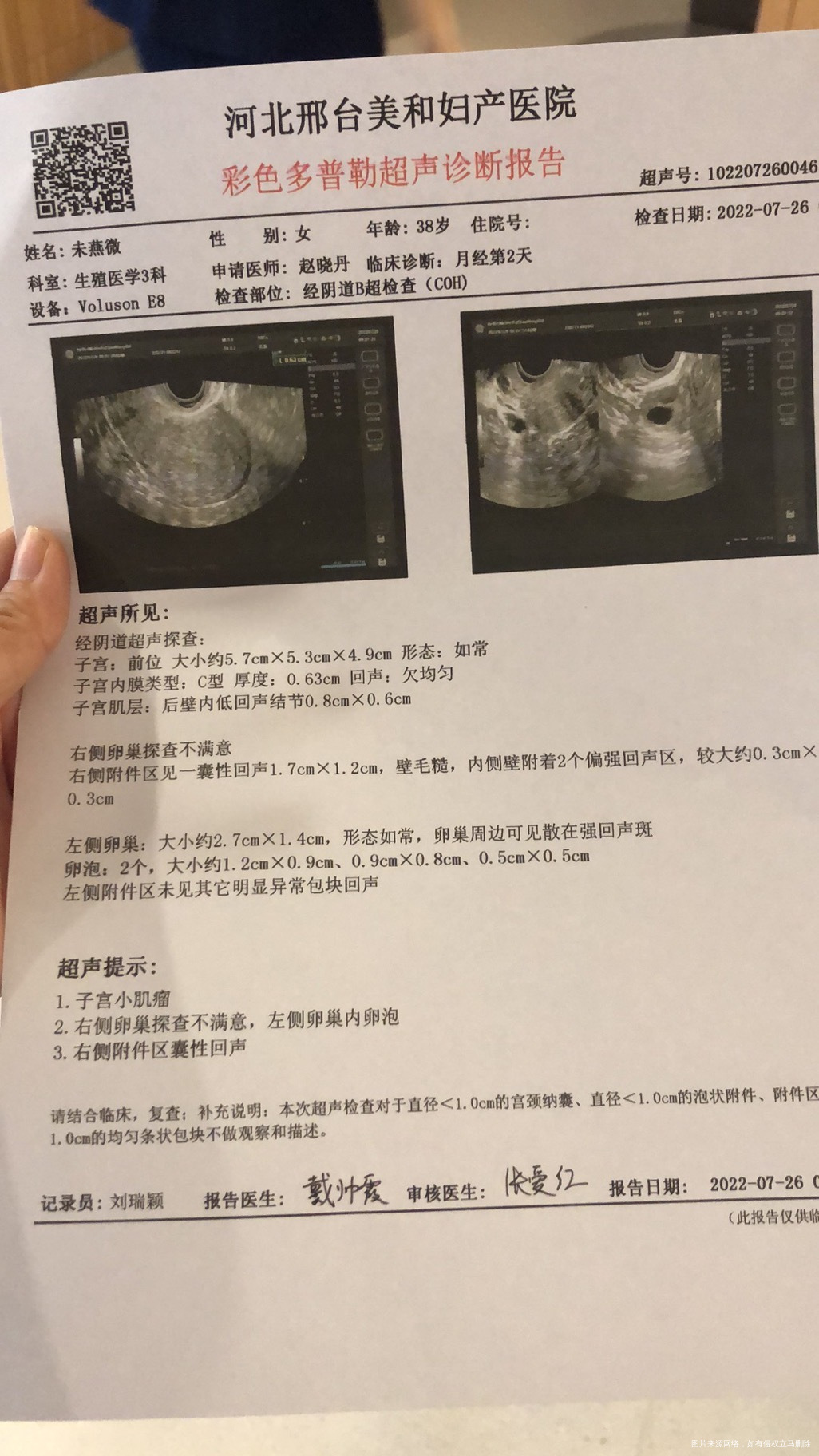 月经第二天最大卵泡12我这个是不是不正常