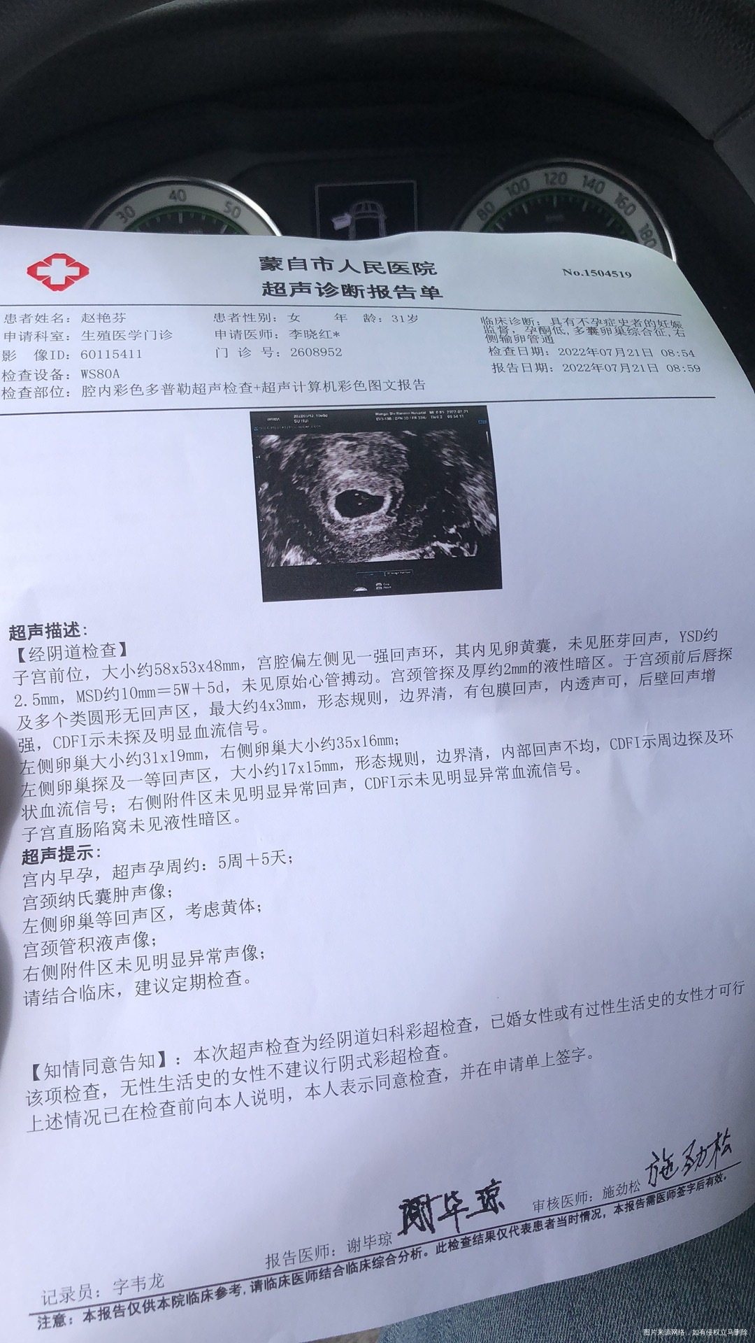 孕早期有腰酸今天有点褐色分泌物这个要去医院吗