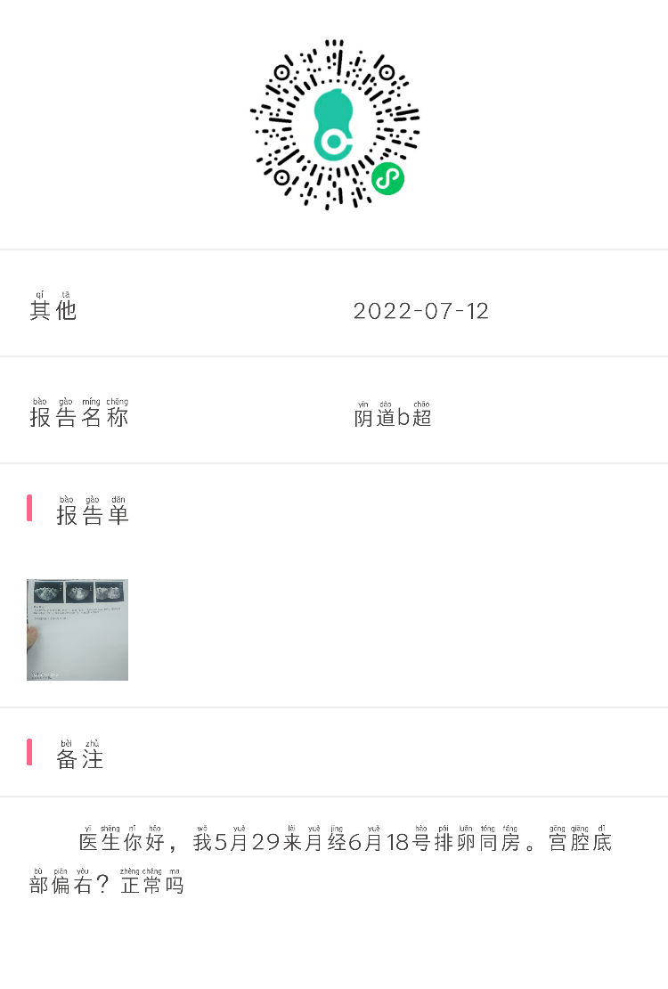 医生你好我5月29号来月经6月18号排卵同房