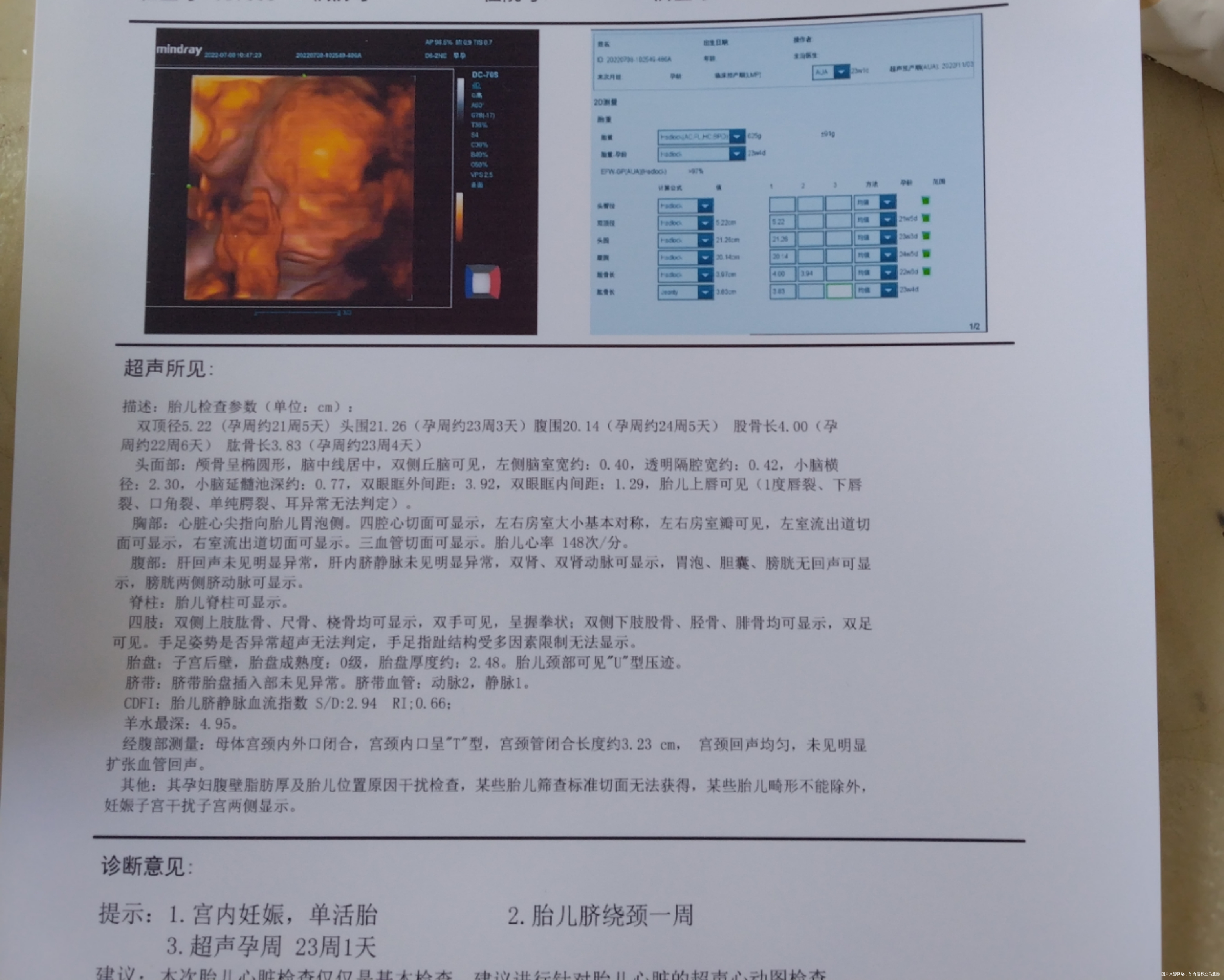 目前孕23+4周今天做的四维麻烦医生给看一下
