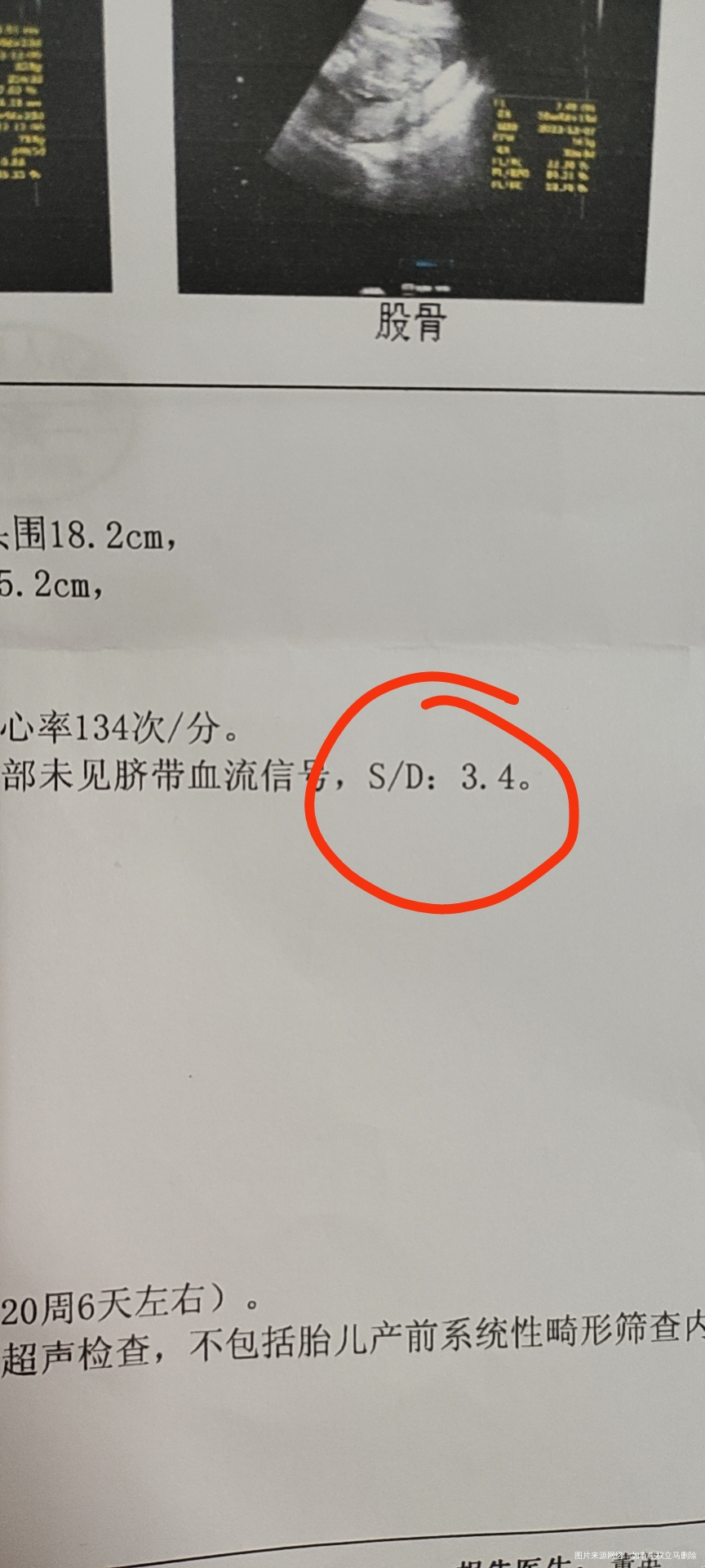 老师们孕20周B超上这个值是什么意思呢上次1