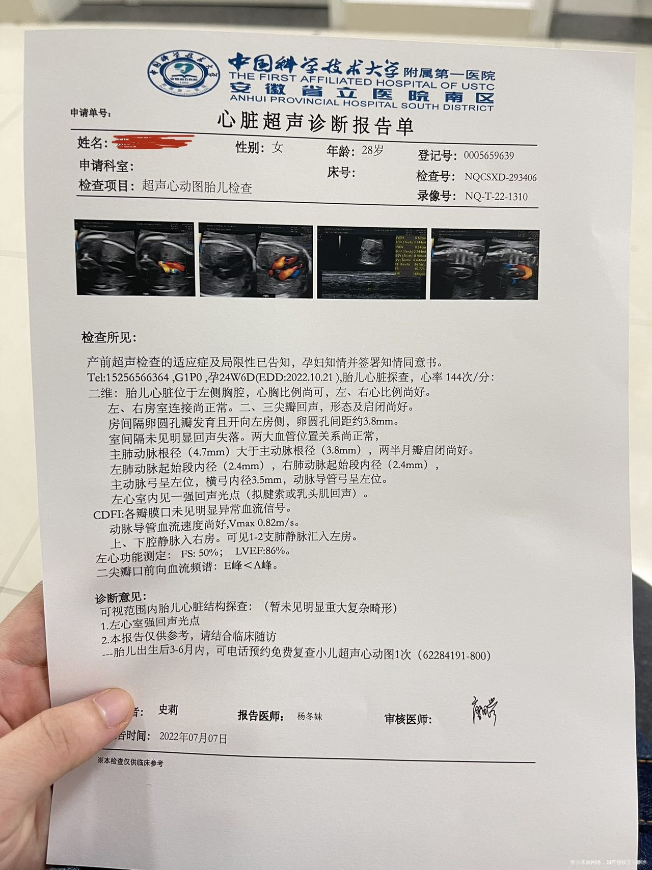 医生您好孕24周做的胎儿心超显示左心室有一个