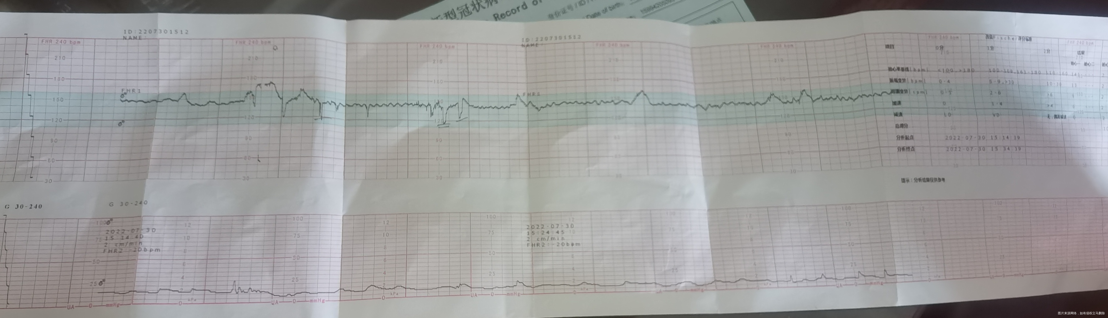 这个胎心监护评分是10分但是这个上面的减速是