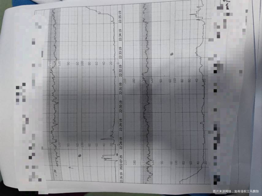 监护怎么样肚子不疼怎么样