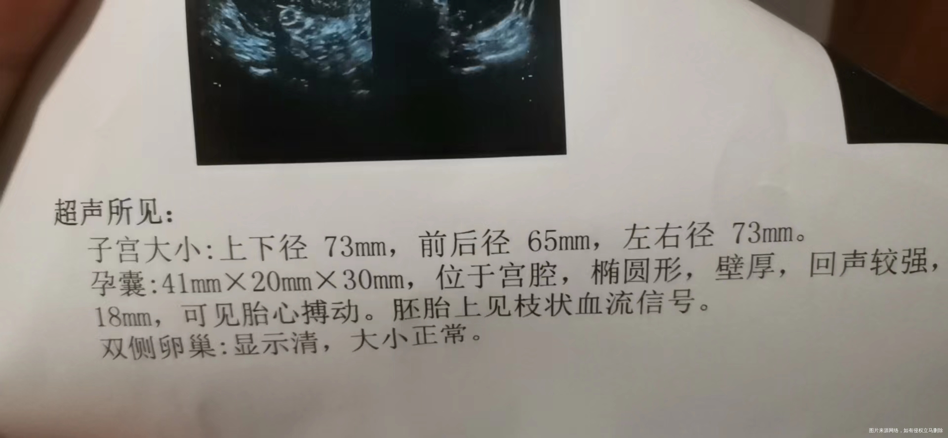 医生你好宝宝已经9周了帮忙看看这个检查结果正