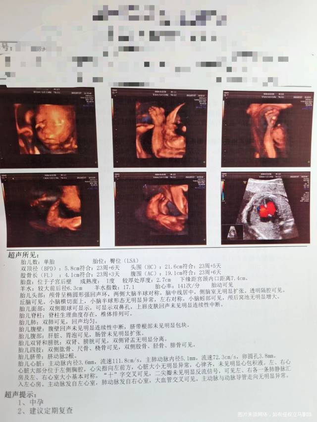 帮忙砍一下四维结果怎么样啊