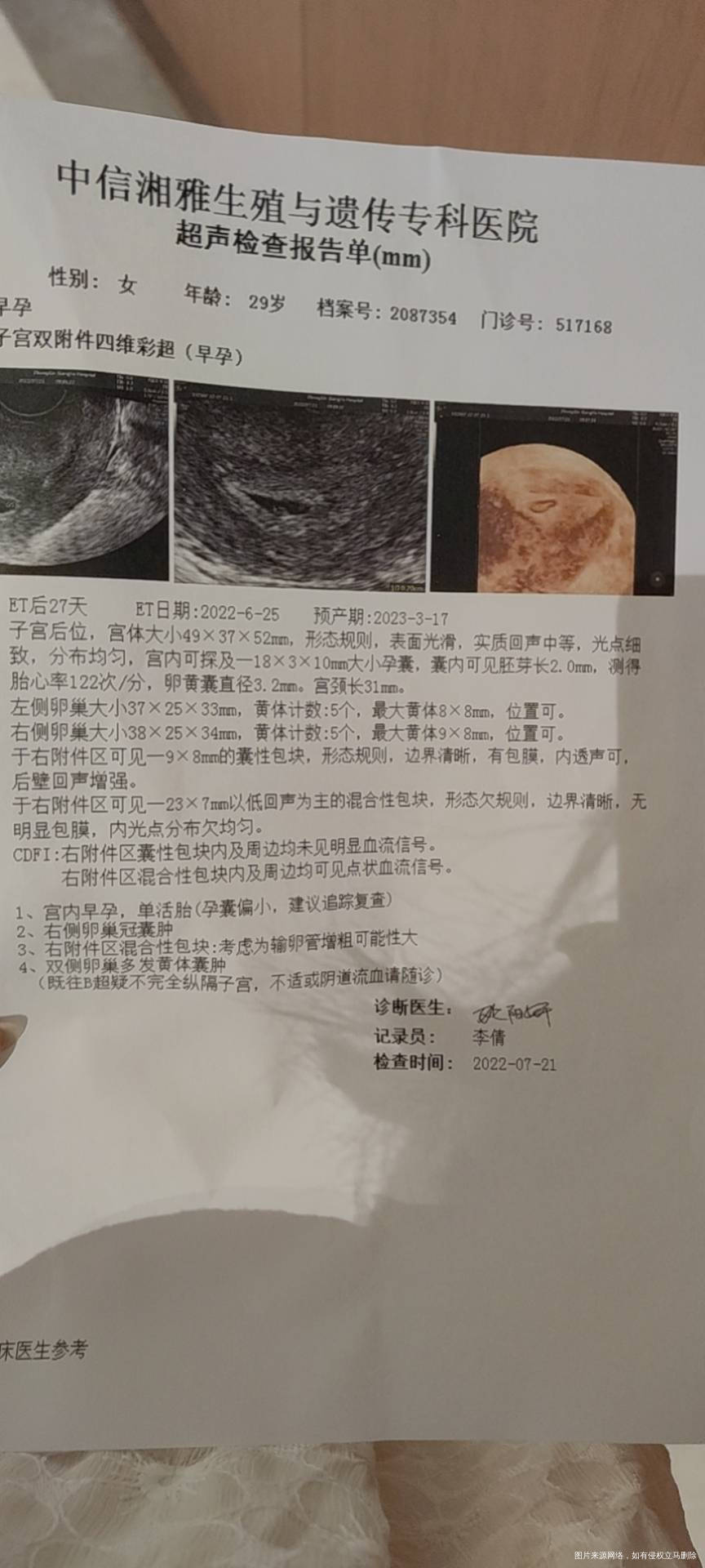 鲜胚移植第14天HCg345第20天自查HC