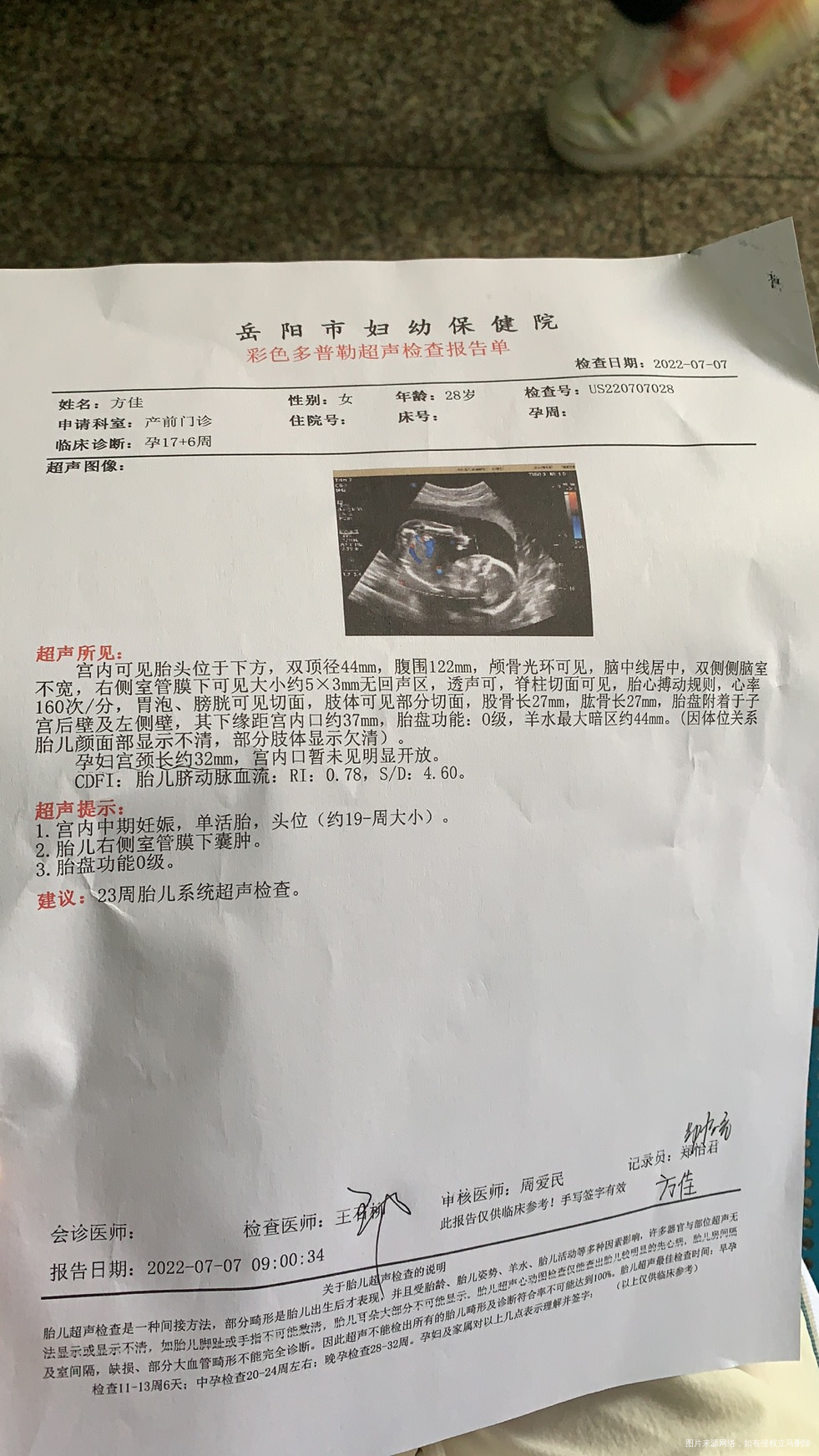 医生请问一下孕中期便秘同房后肚子疼痛一晚今天