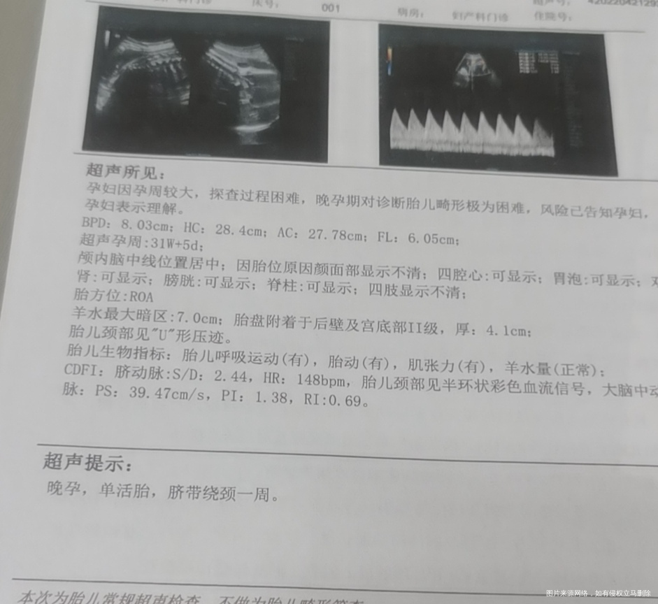 这B超小排畸宝宝的数值符合孕周吧孕31+5