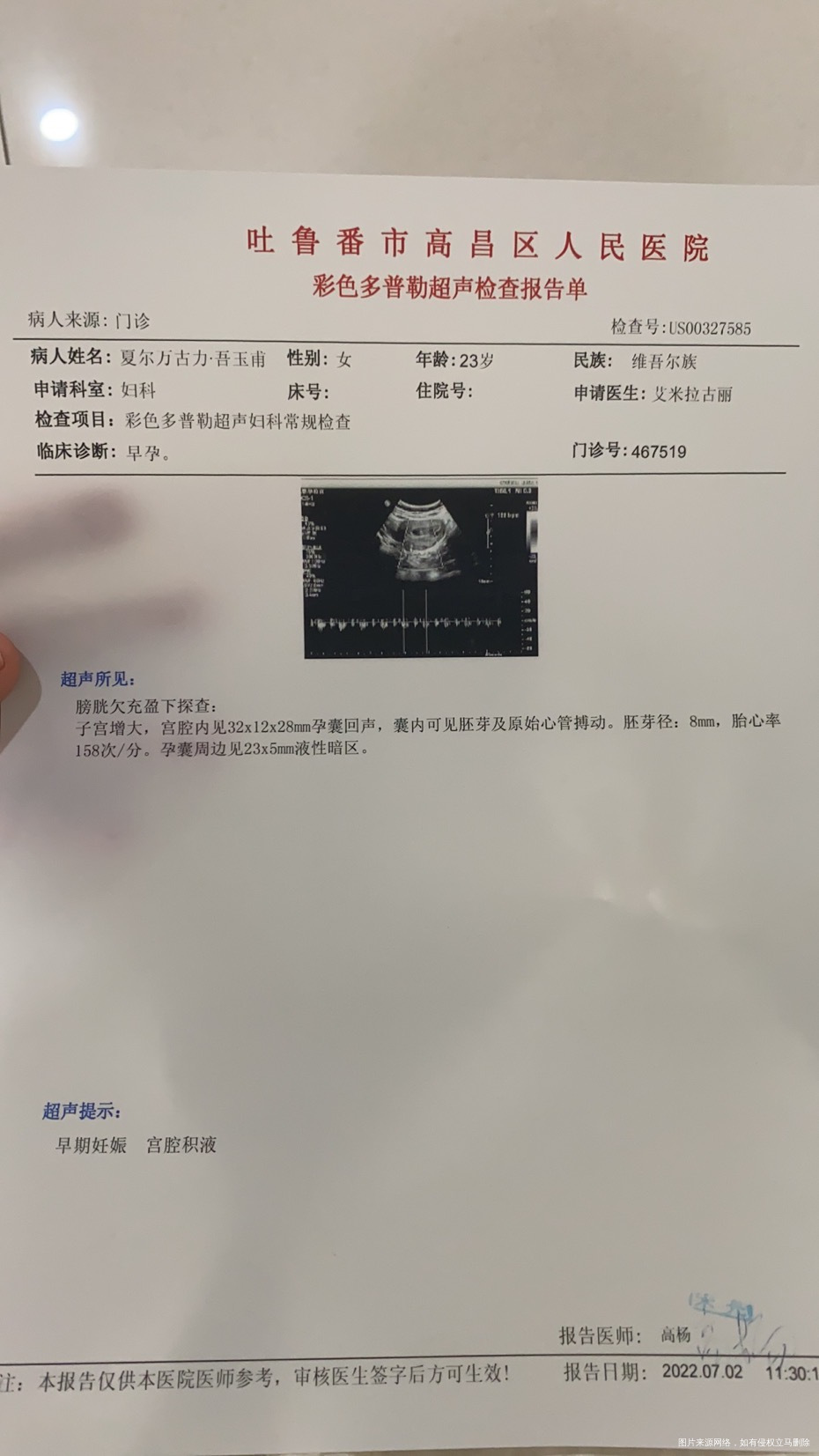 各位医生帮我看下我现在住院一个星期了一直保胎