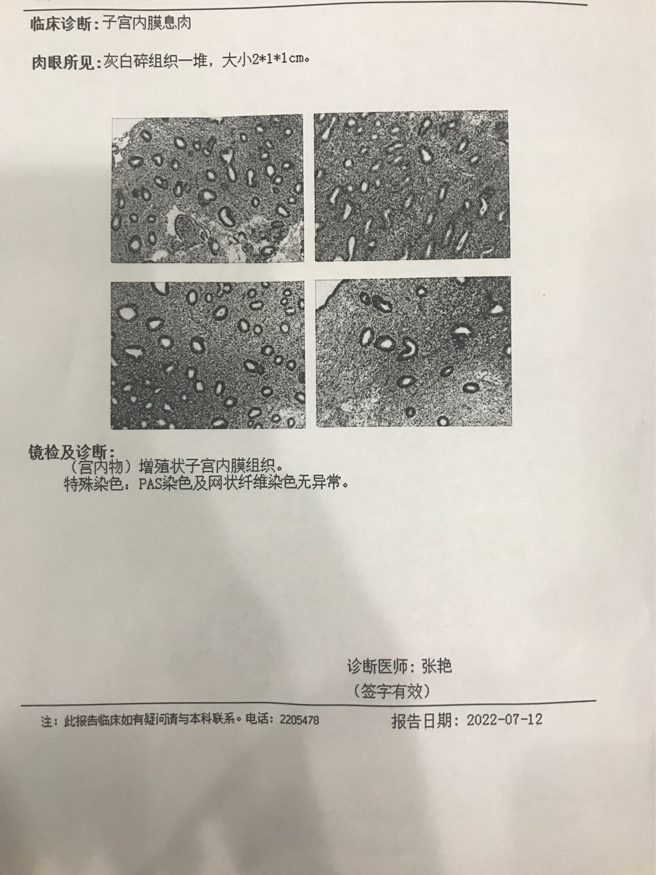 医生这是宫腔镜手术后报告帮忙看下是否正常呢下