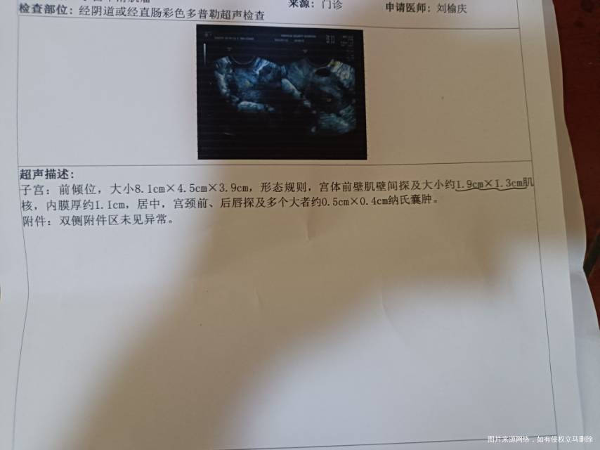 子宫肌瘤对试管有没有影响