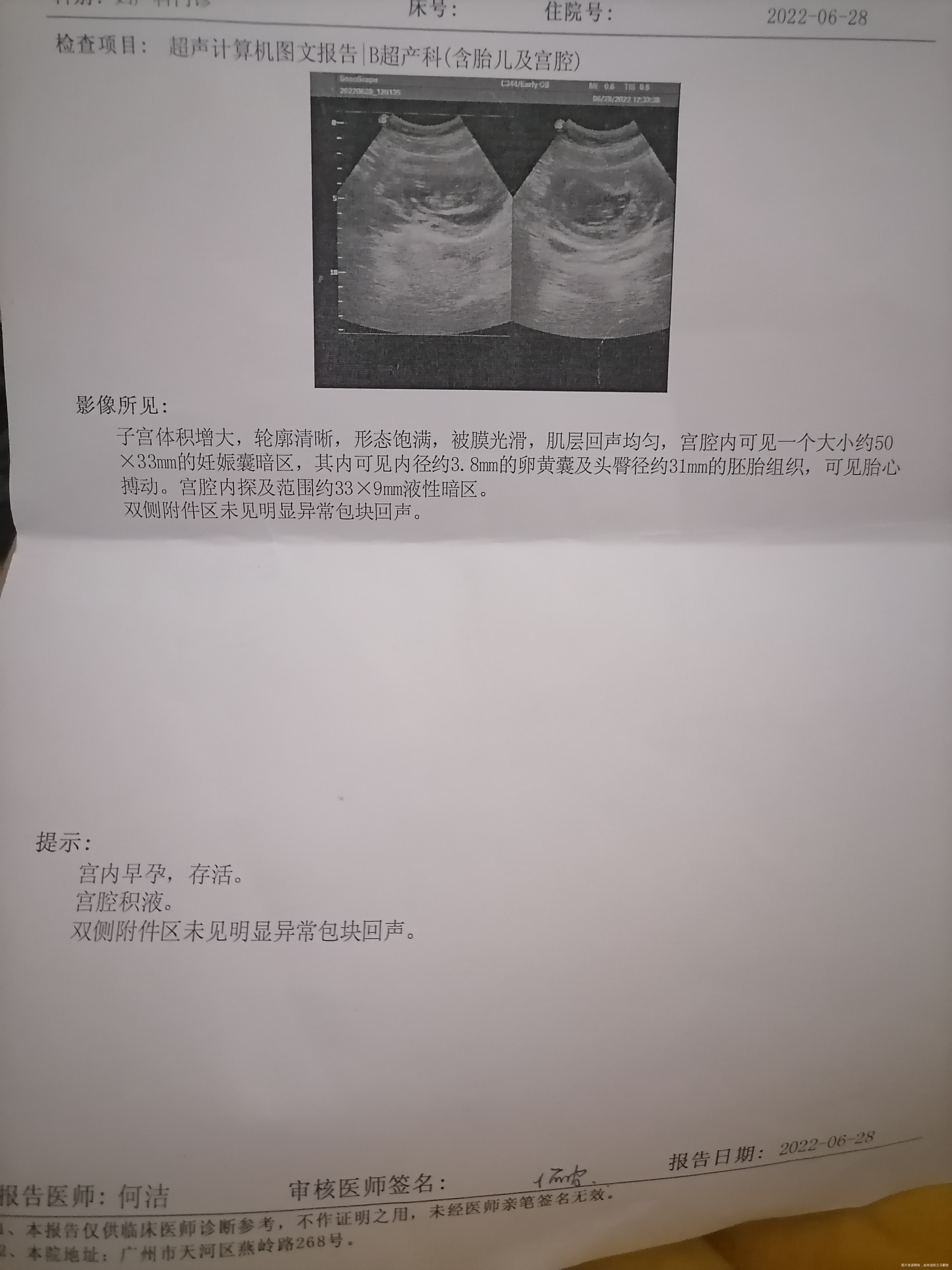 主任我现在孕十周多第一张是6月28做的b超第