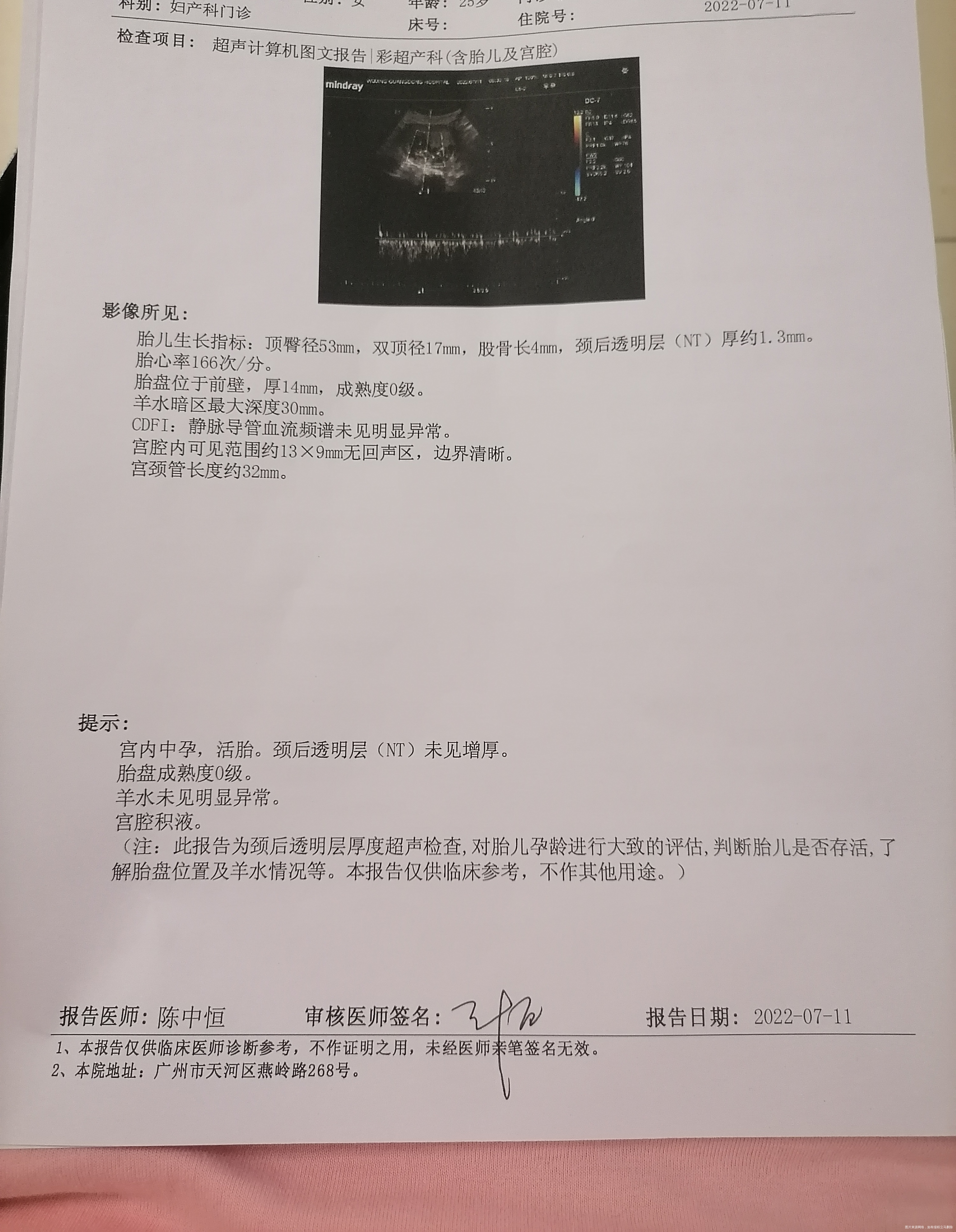 主任我这个NT结果正常吗