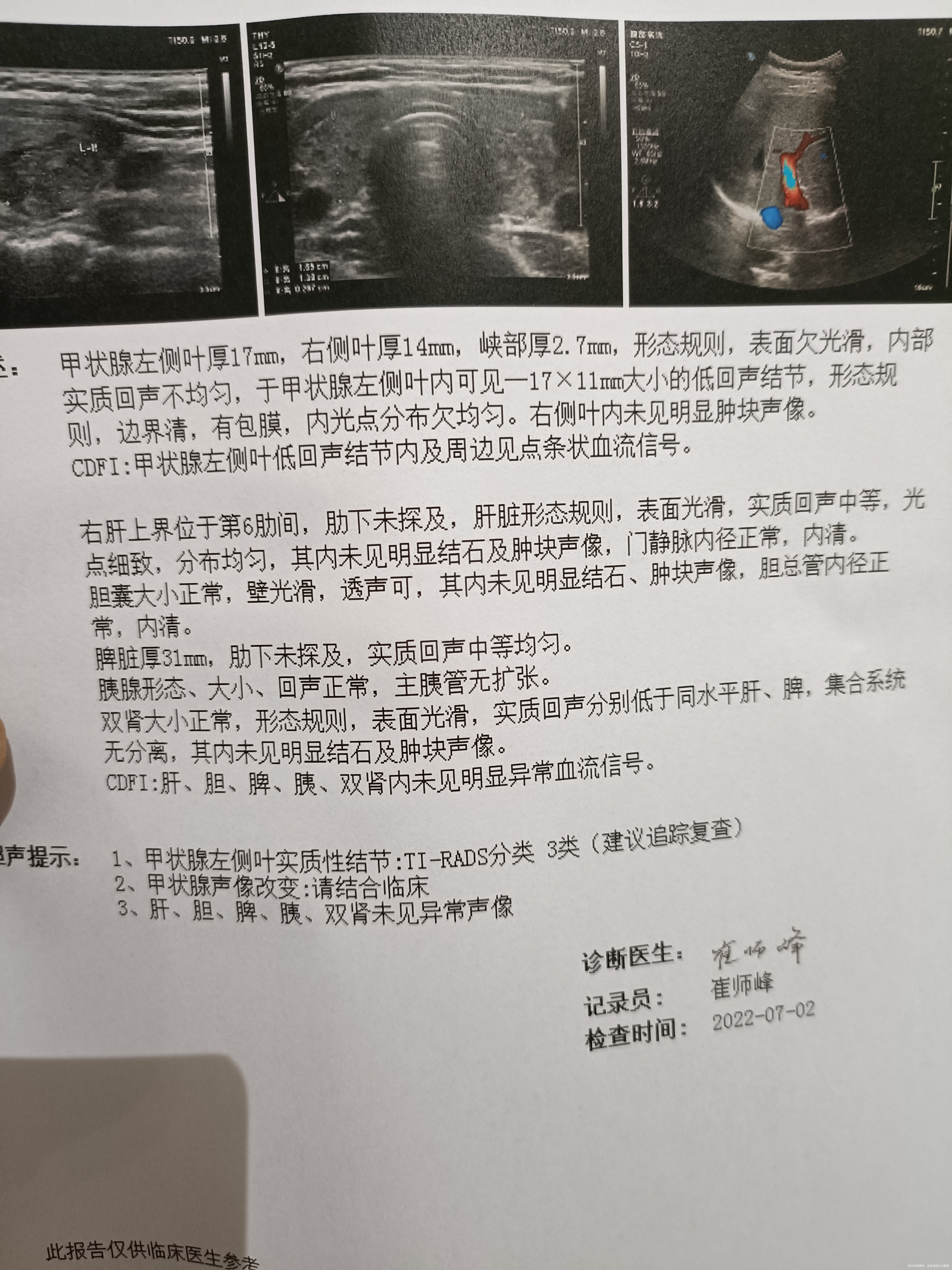 这个正常吗自己看不懂