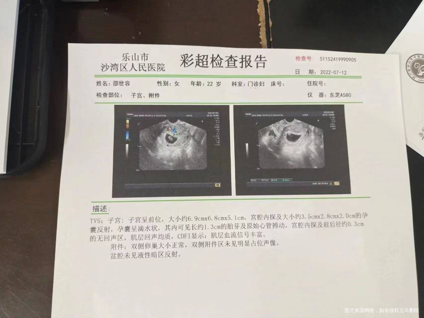 移植36天早上突然腹痛大出血第1张照片是昨天
