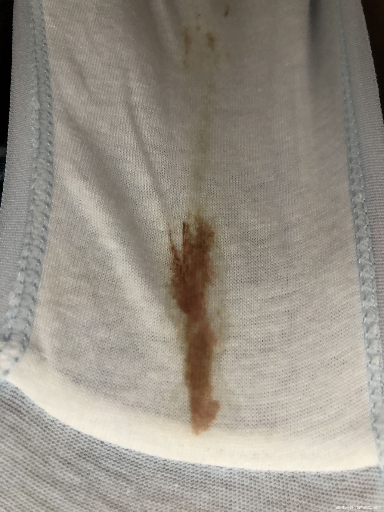 孕早期有腰酸今天有点褐色分泌物这个要去医院吗