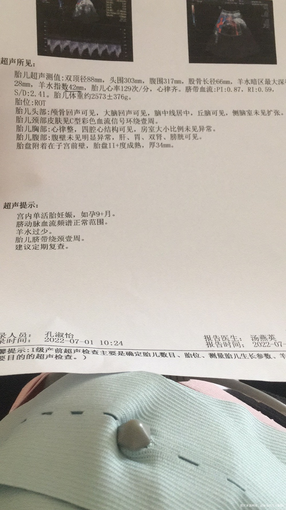 医生你好帮忙看看这个彩超结果是不是羊水过少了