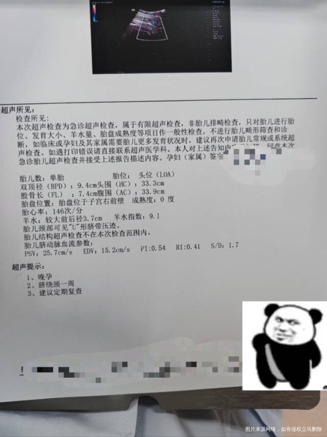 大夫这个结果怎么样39周了一直没动静天气热想