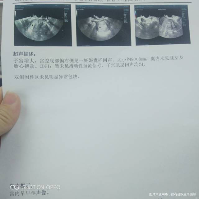 医生你好我5月29号来月经6月18号排卵同房