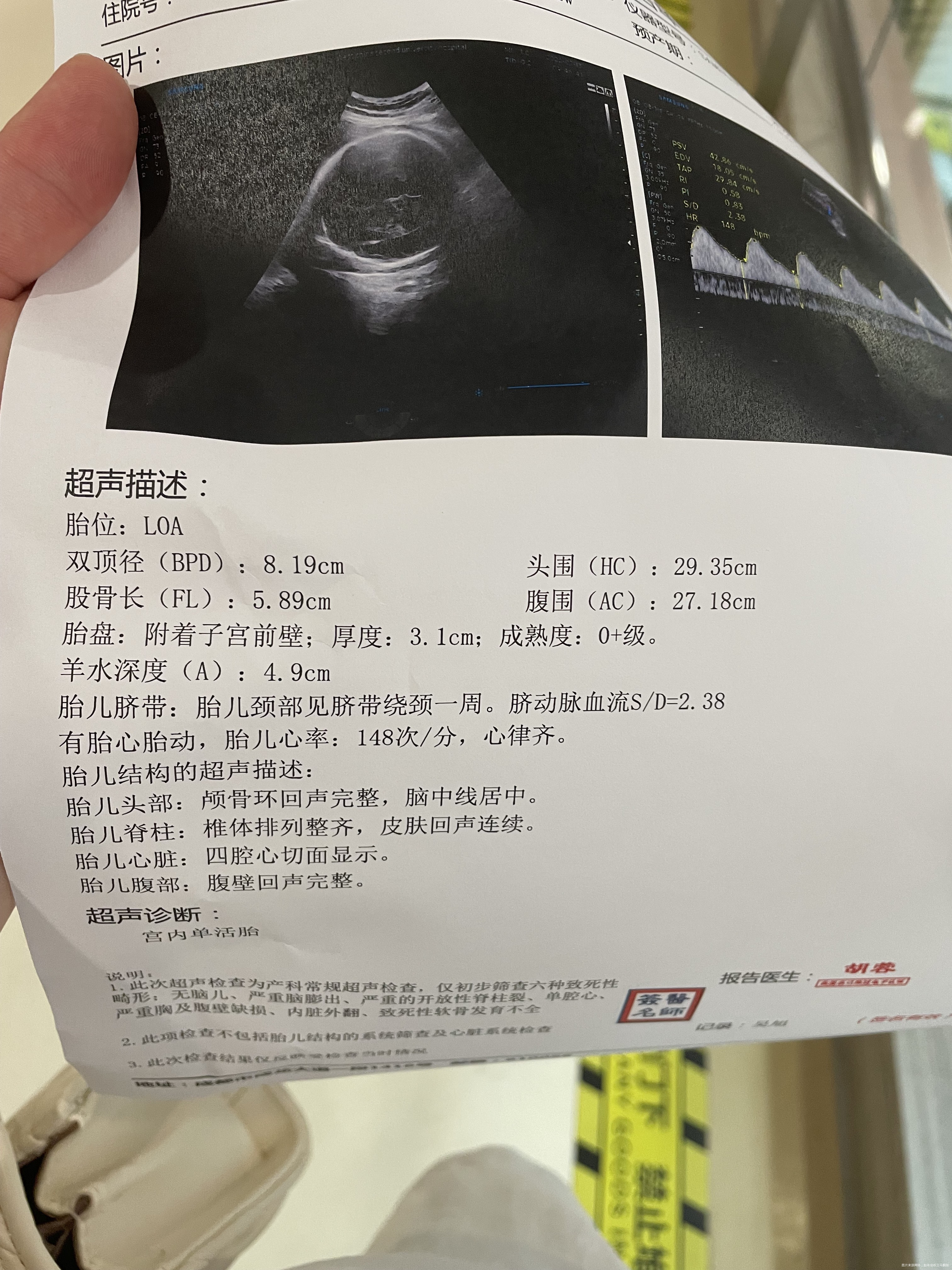 末次月经12月1日预产期9月7日今天32周b