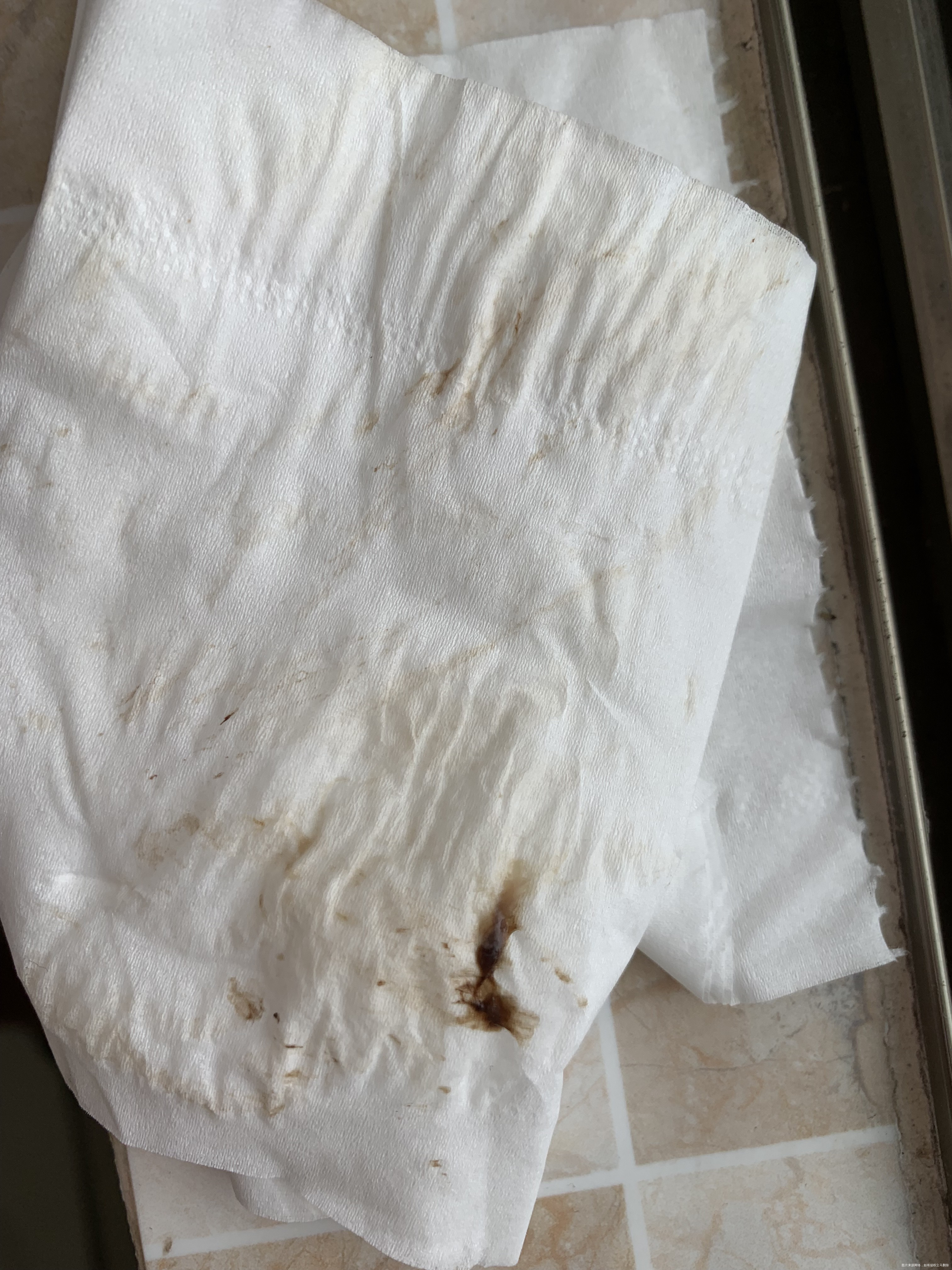 孕26周第一张和第二张图是9号的10号白带偏