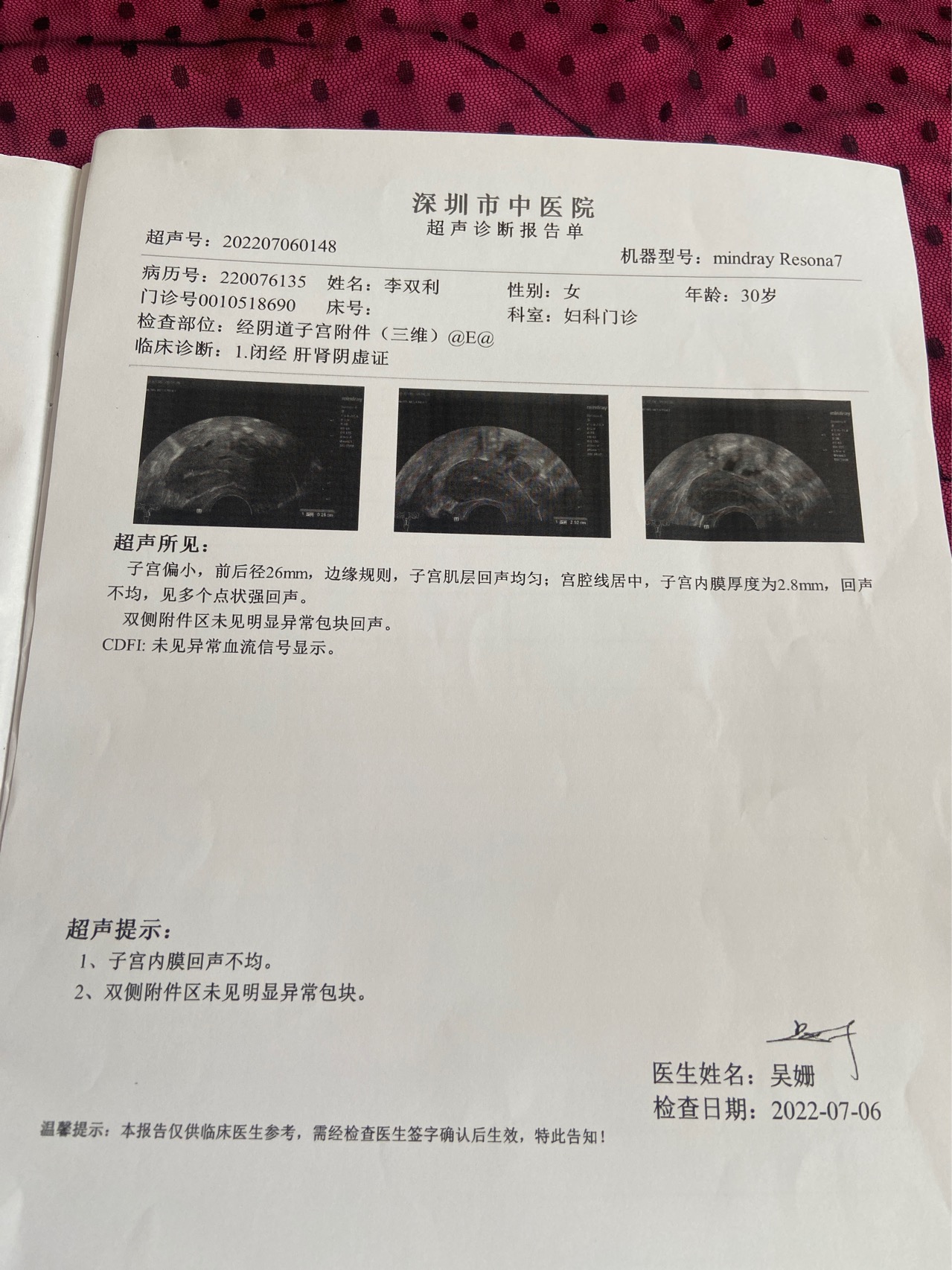 今年30岁2019年3月12日剖腹产产女之后