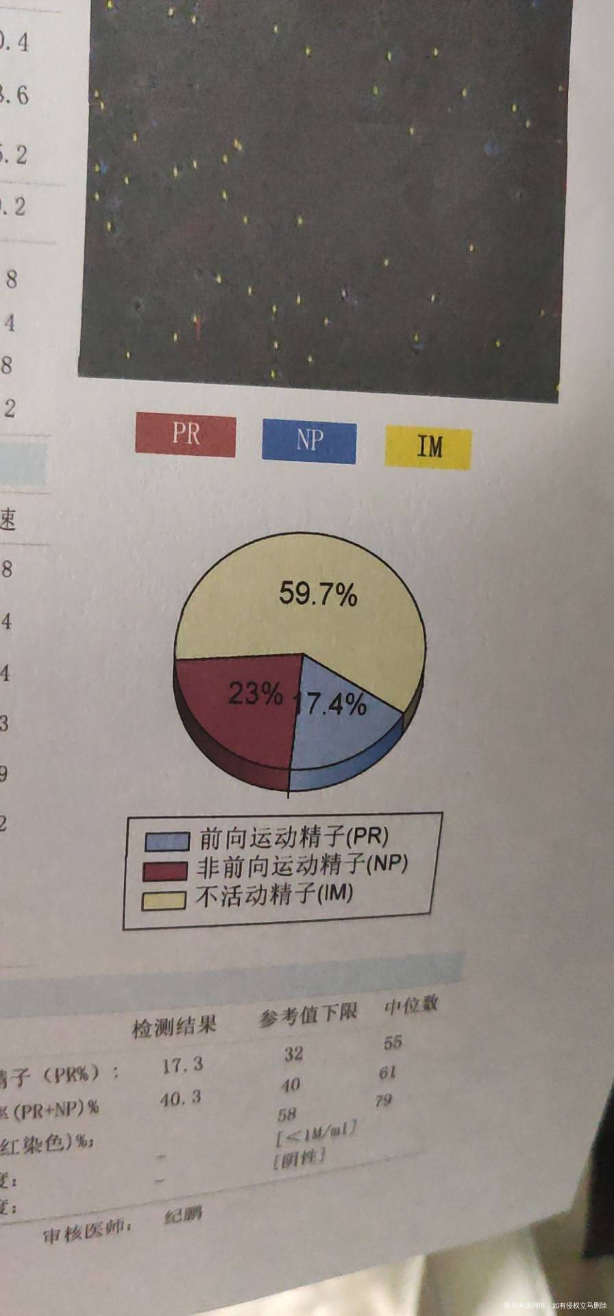 这种是什么情况精子成活率是多少
