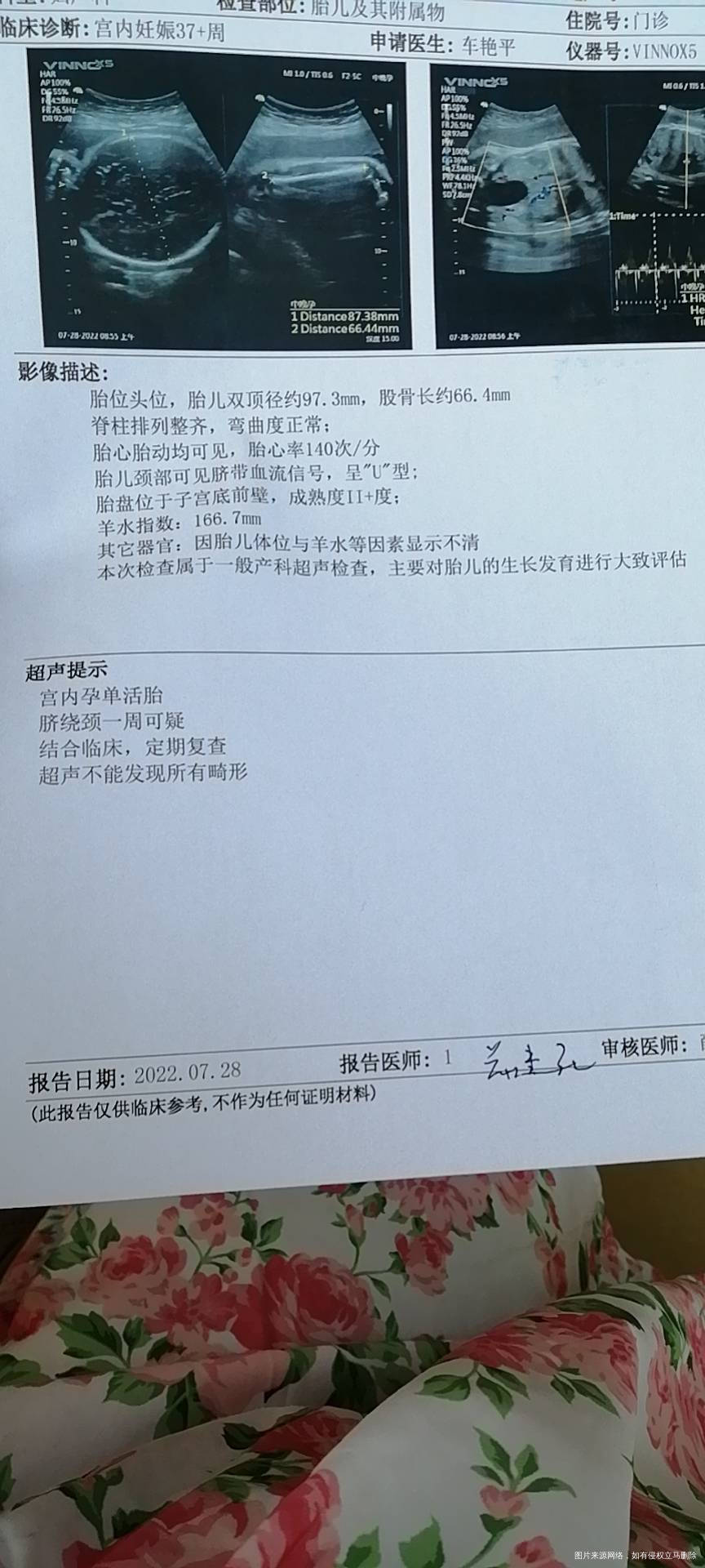 36+6了麻烦看一下这个数值孩子有几斤是不是