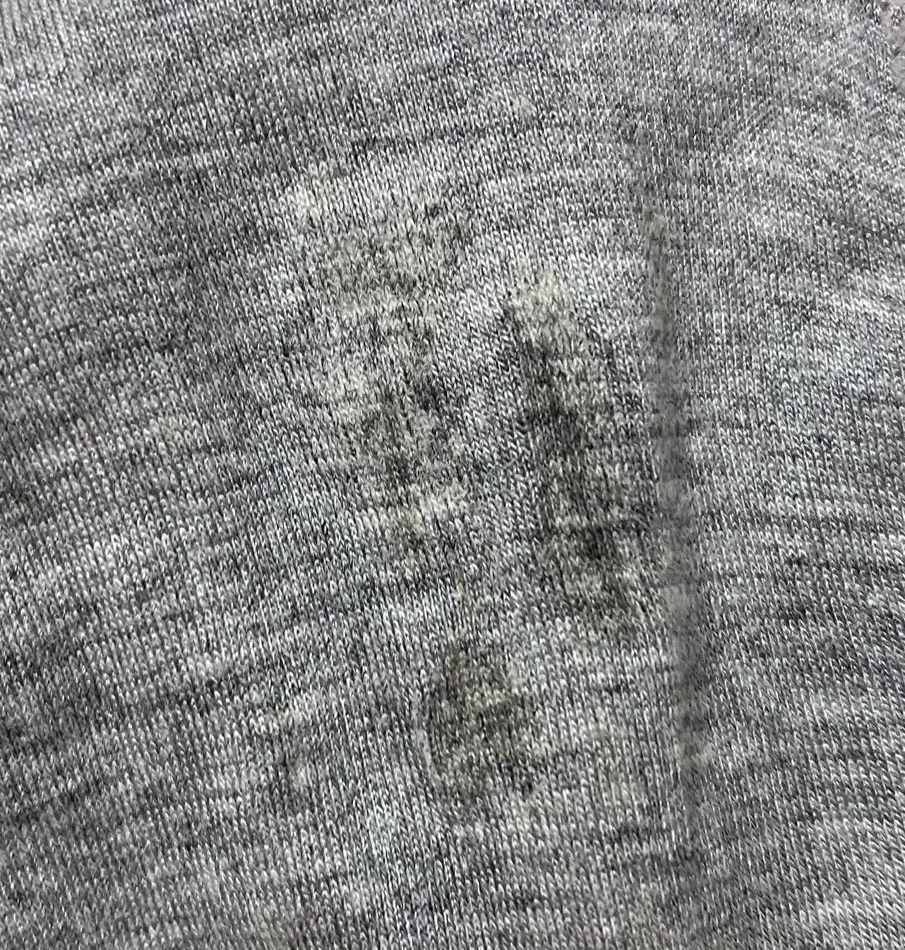 一走路或者一使劲内裤上都是白带分泌物正常吗