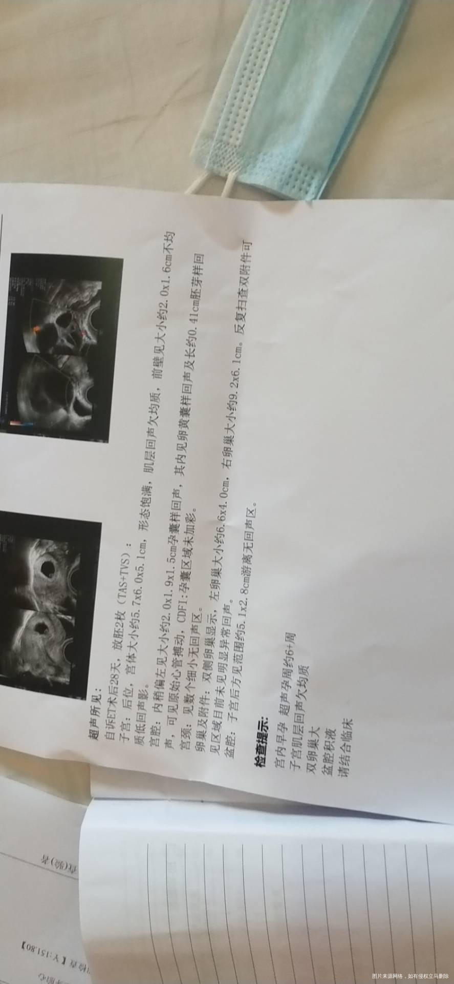 今天打一超小肚子里面偶尔疼子宫也刺疼有没有影