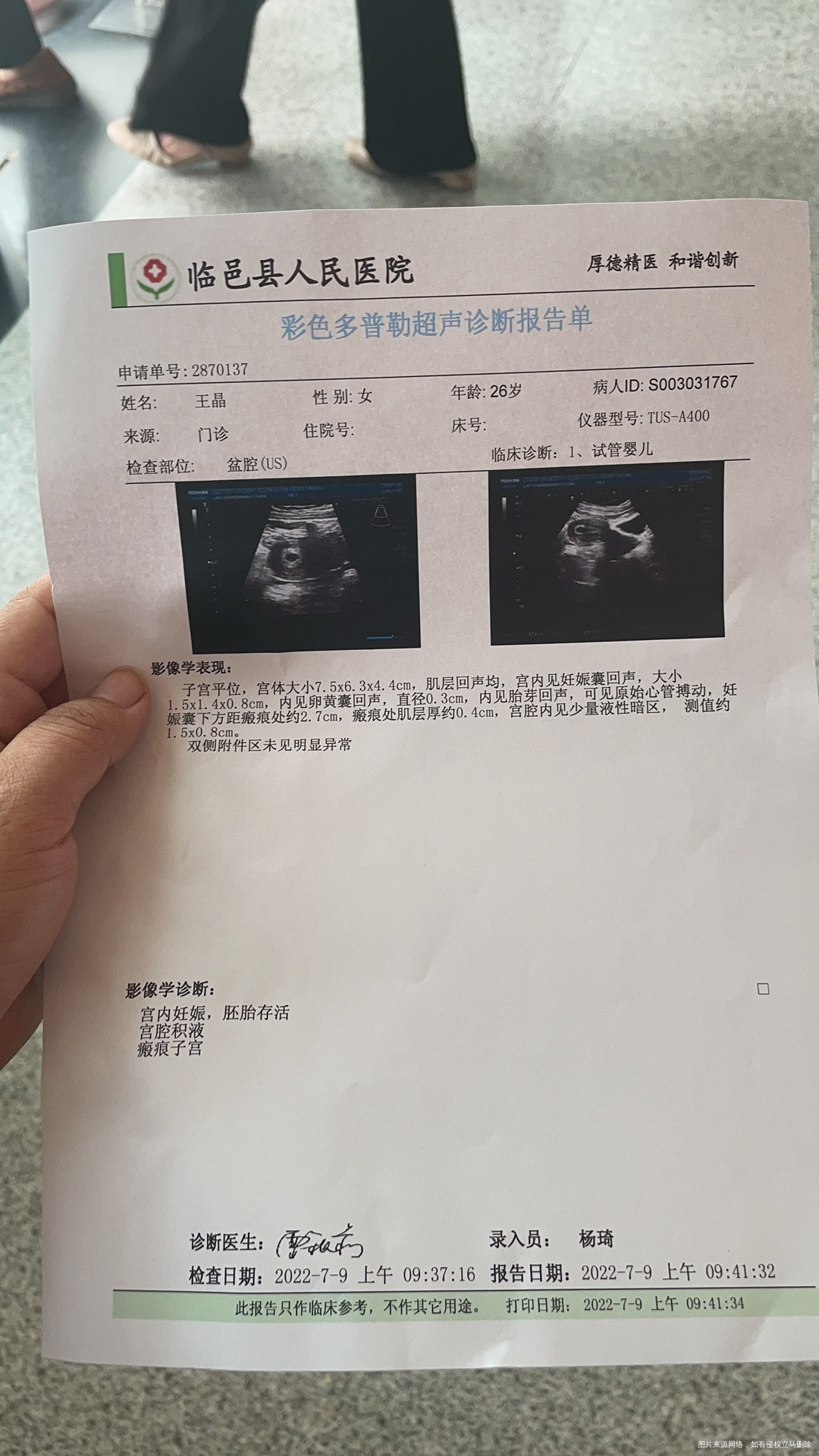 试管怀孕6+3昨天已经测出胎心胎芽但是今天用
