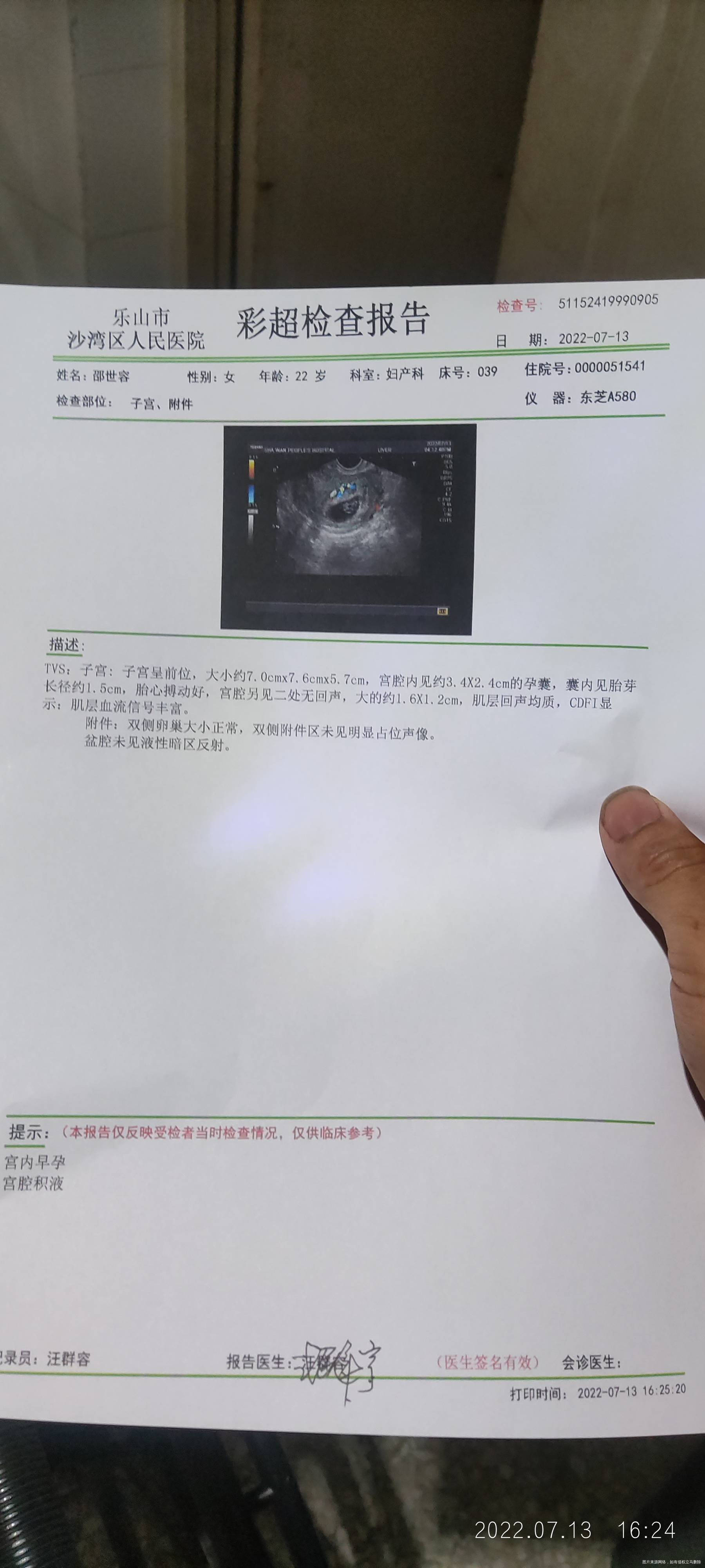 12号早上腹痛大出血到医院输止血保胎第二天到