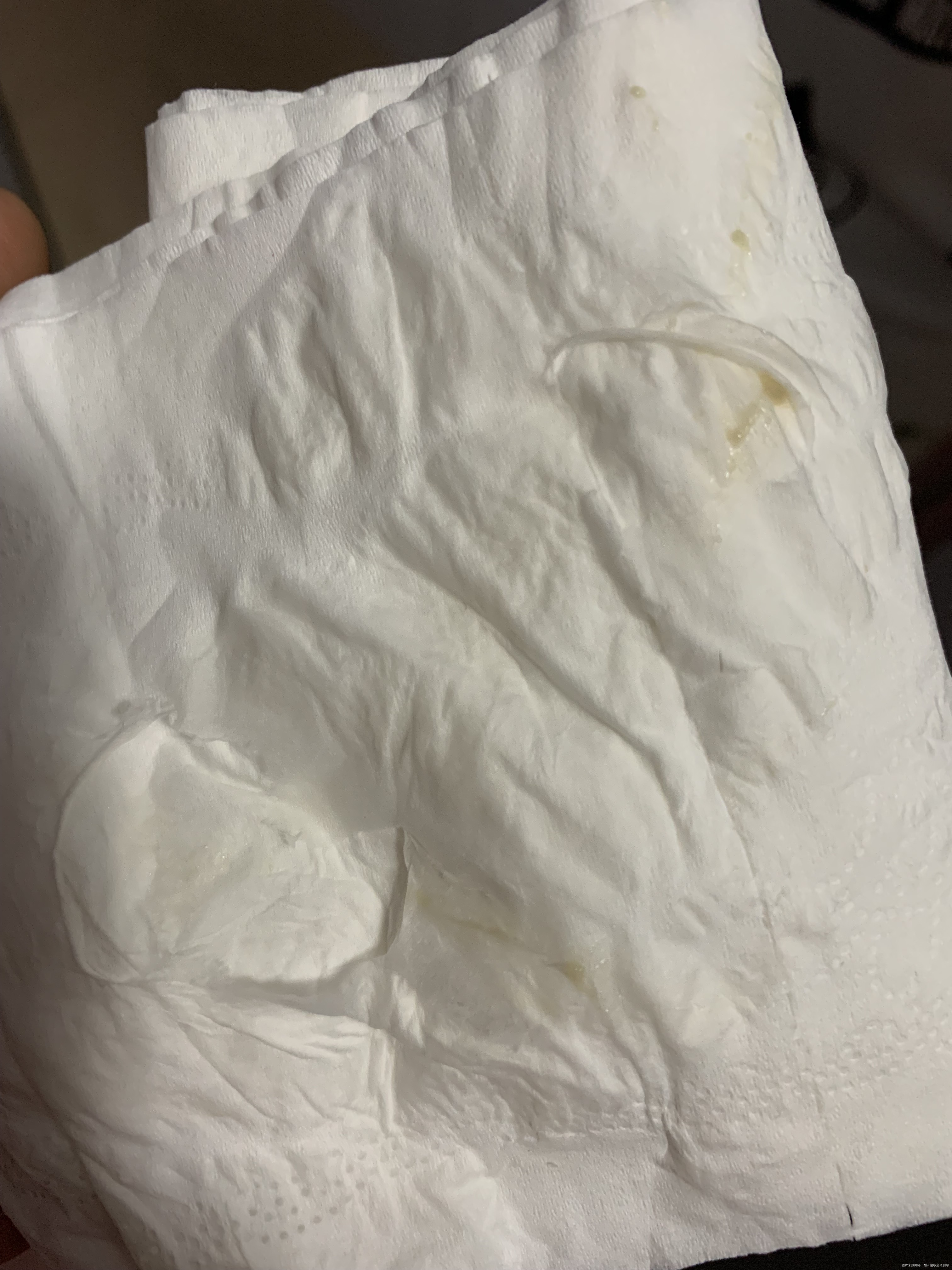 孕26周上厕所有图一的颜色是出血吗内裤上也有