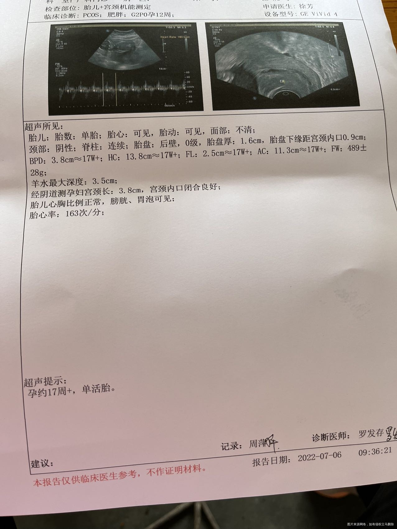 17周了之前nt时候胎盘低今天复查了宫颈机能