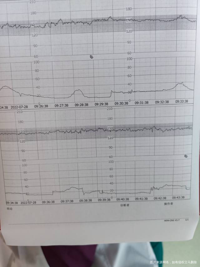 刚做的监护排队人太多怎么样34周