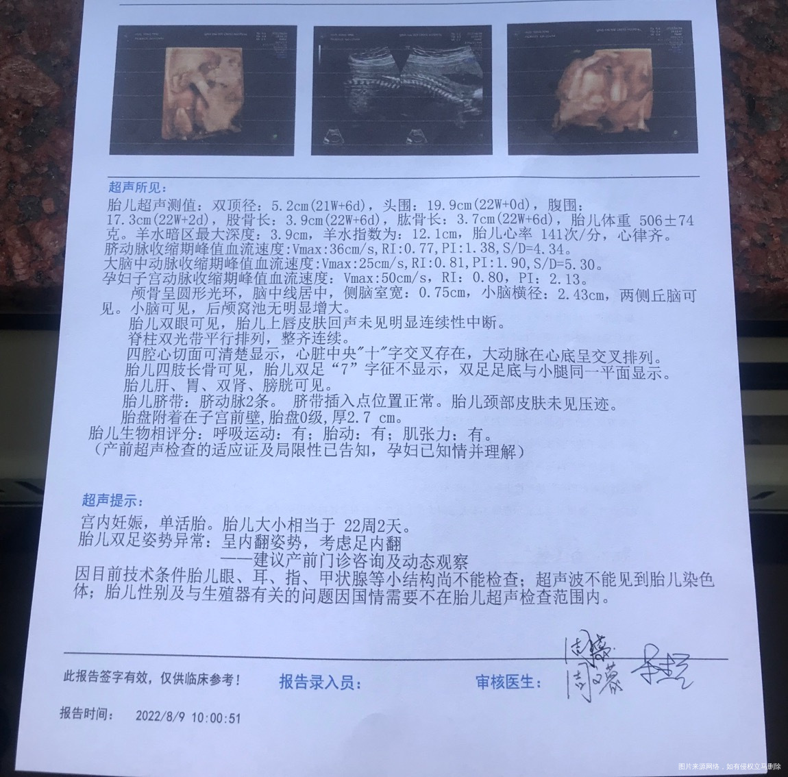 做的四维足内翻有什么办法吗