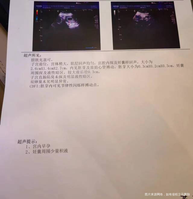 6周➕2孕囊周围有积液检查回来后还是一直有褐