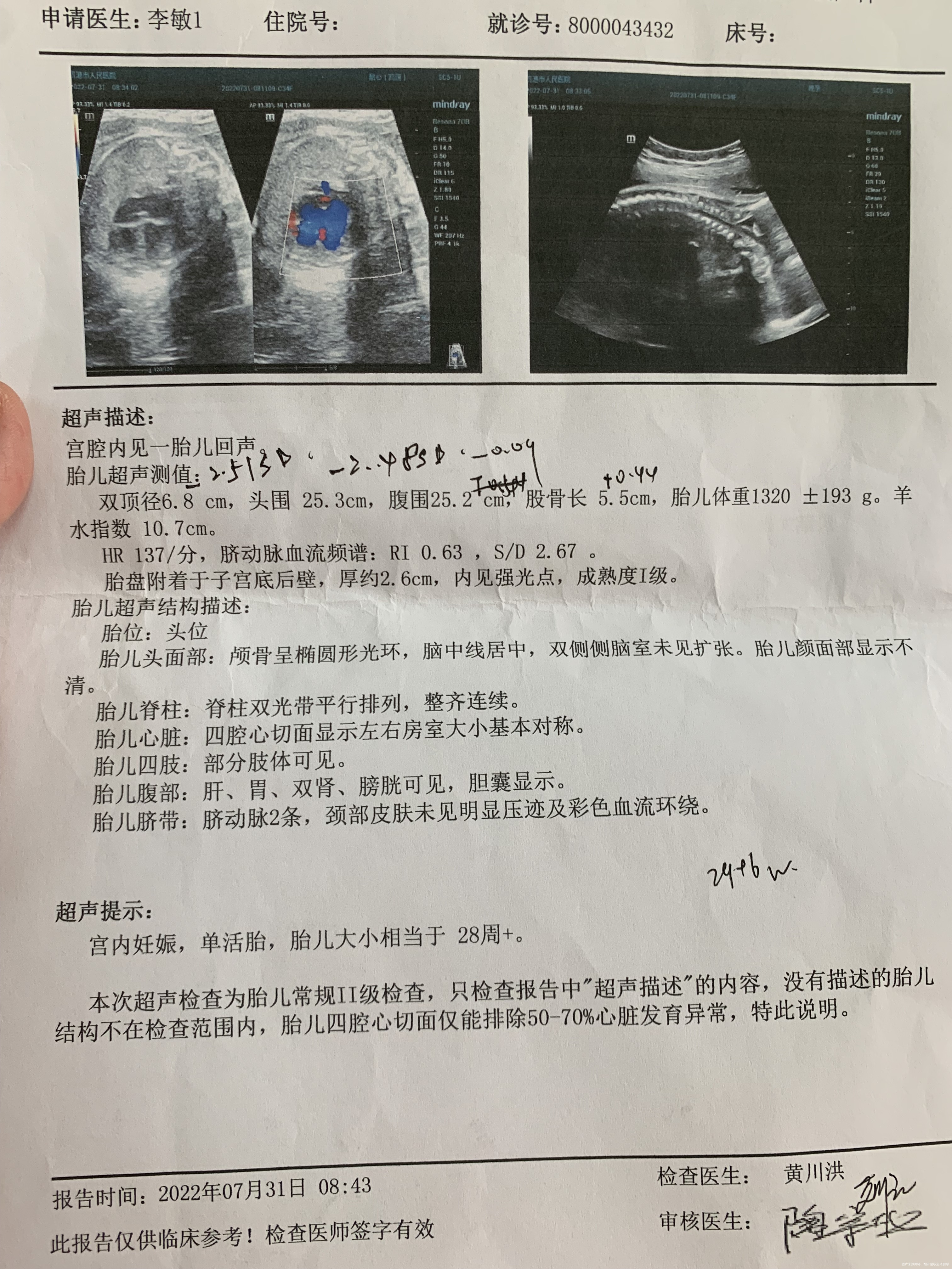 昨天在当地医院做彩超没见绕颈今天到上一级医院