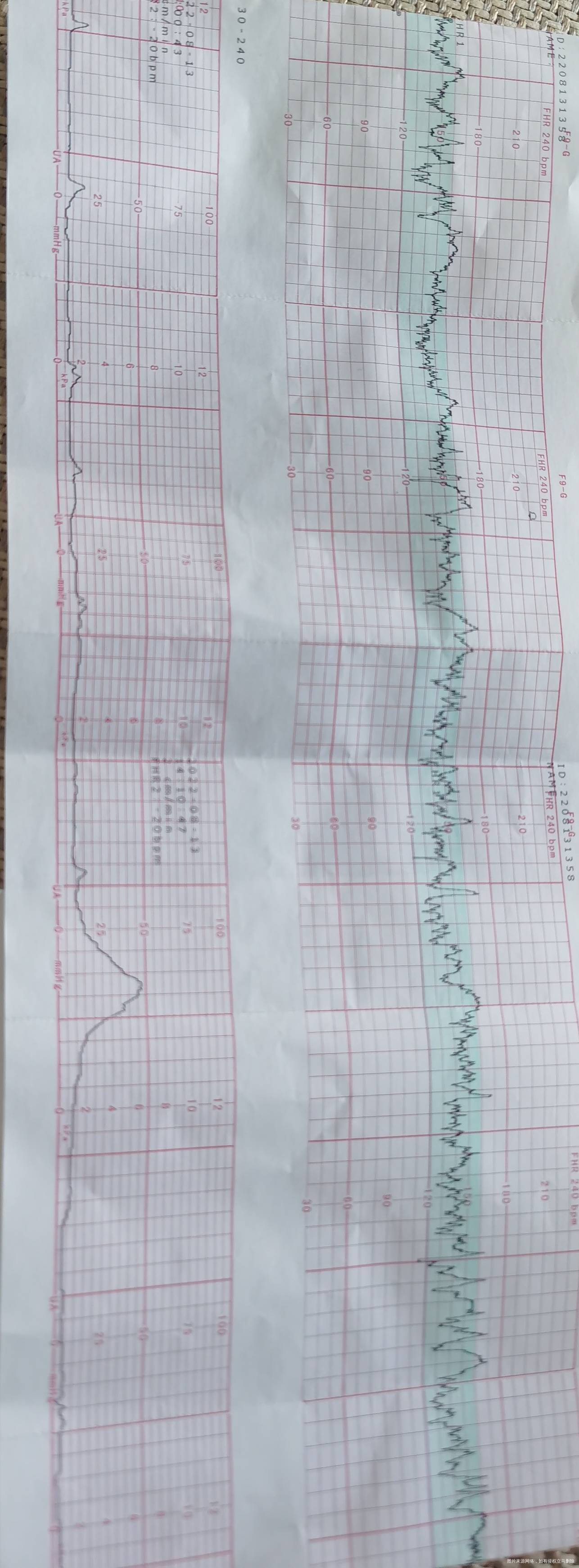 宝宝胎心监护到37周以后总是不稳定是什么原因