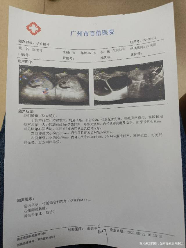 目前这种情况还留得住吗下腹右侧偶尔有点胀正常