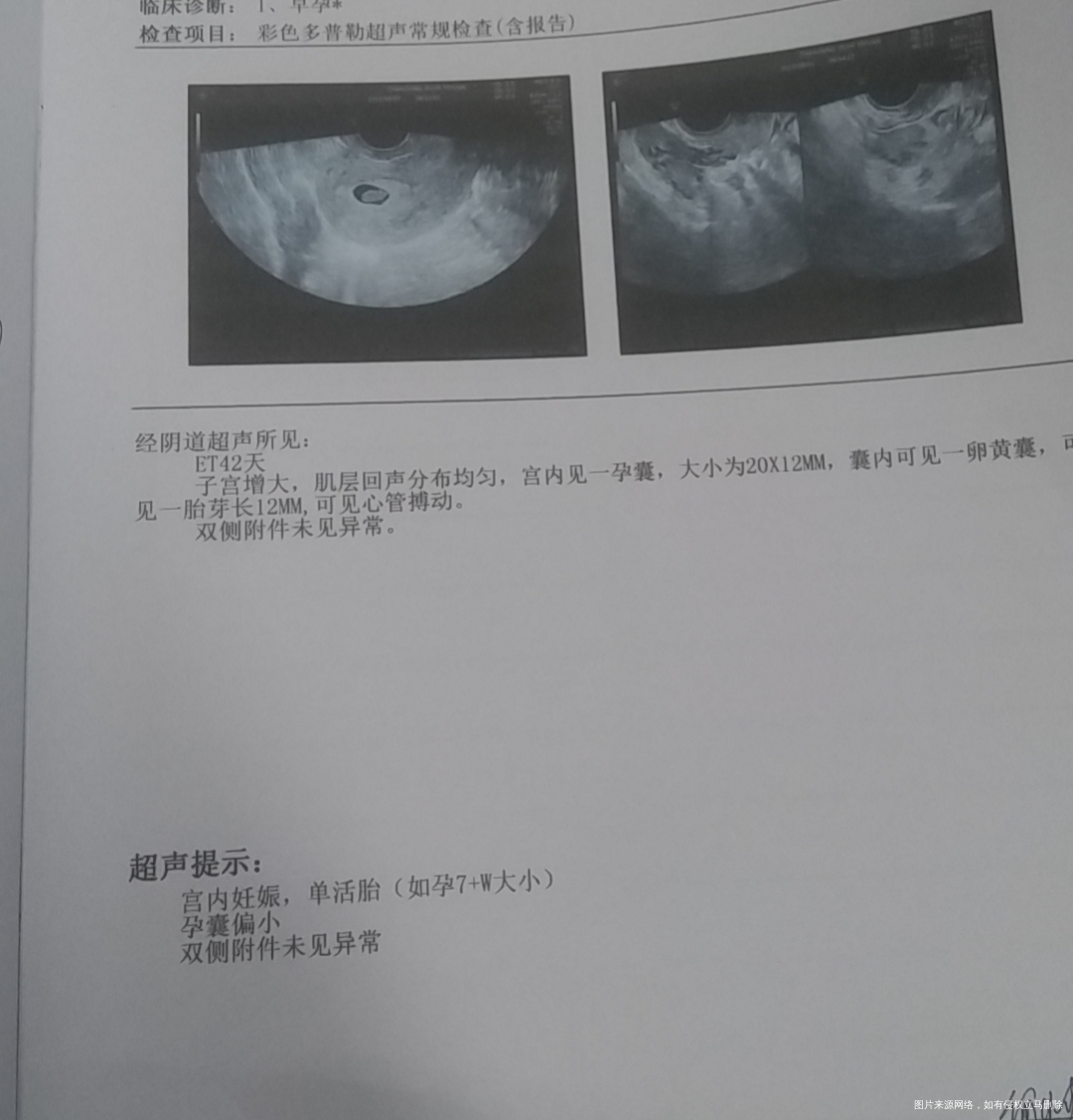移植冻胚42天血值35000