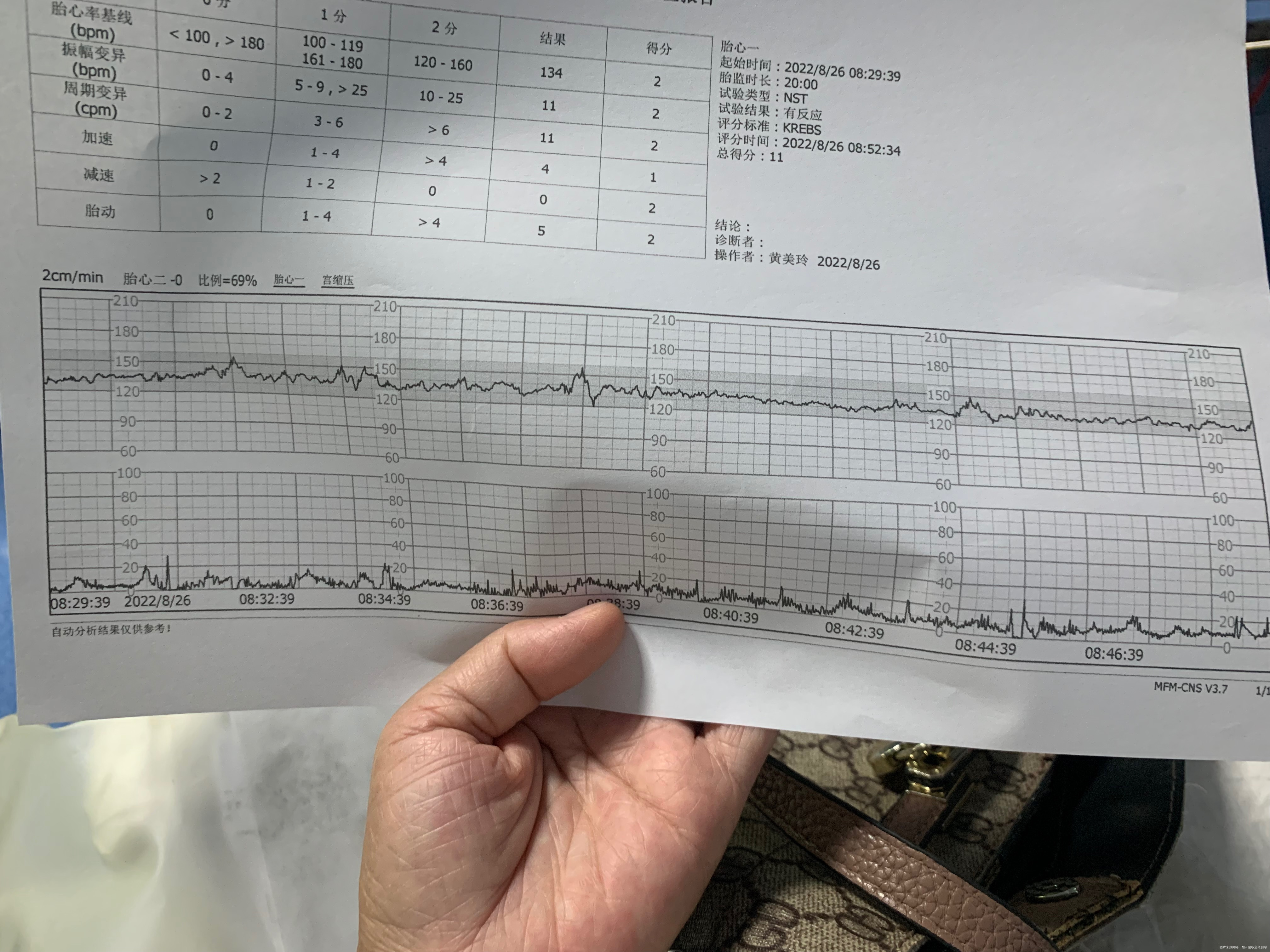 33周+4第一次做胎监这个曲线正常吗