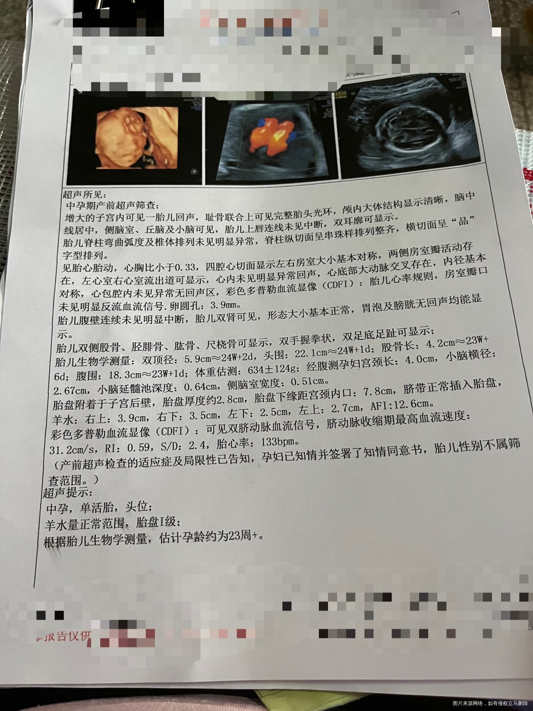 孕23周+我老公A血型我O血型孕期24周查A