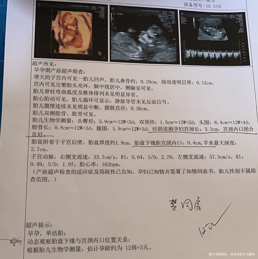 做nt的时候胎盘低这次做了四维看一下可以同房