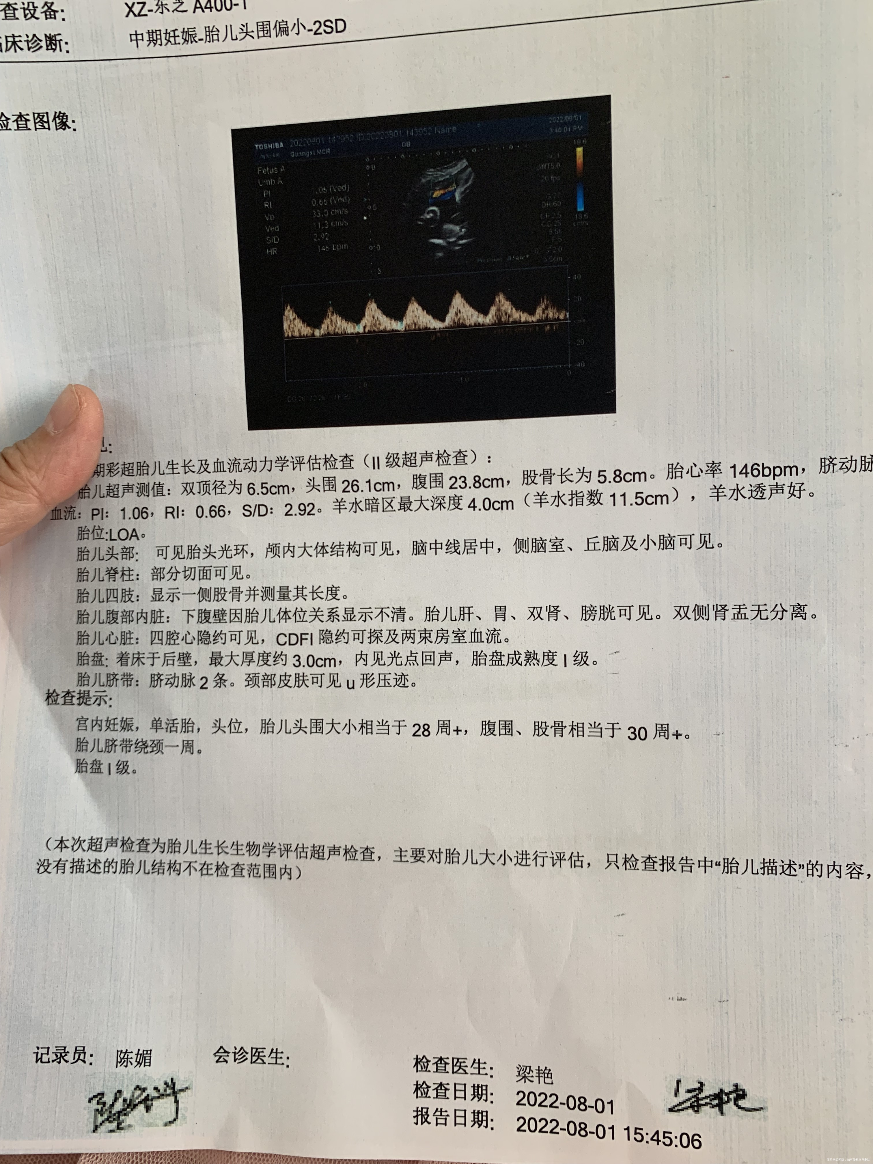 昨天在当地医院做彩超没见绕颈今天到上一级医院