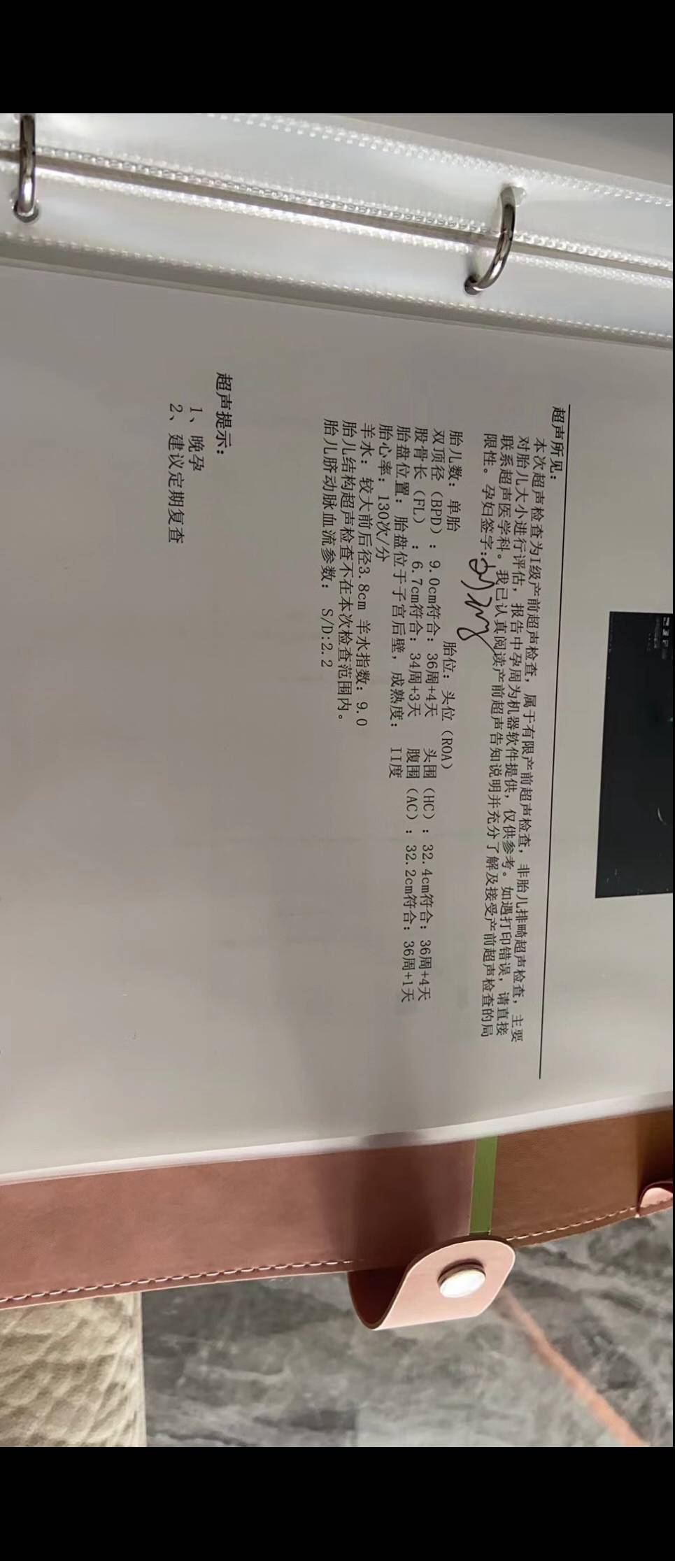 孩子腿短很焦虑本来我俩就不高