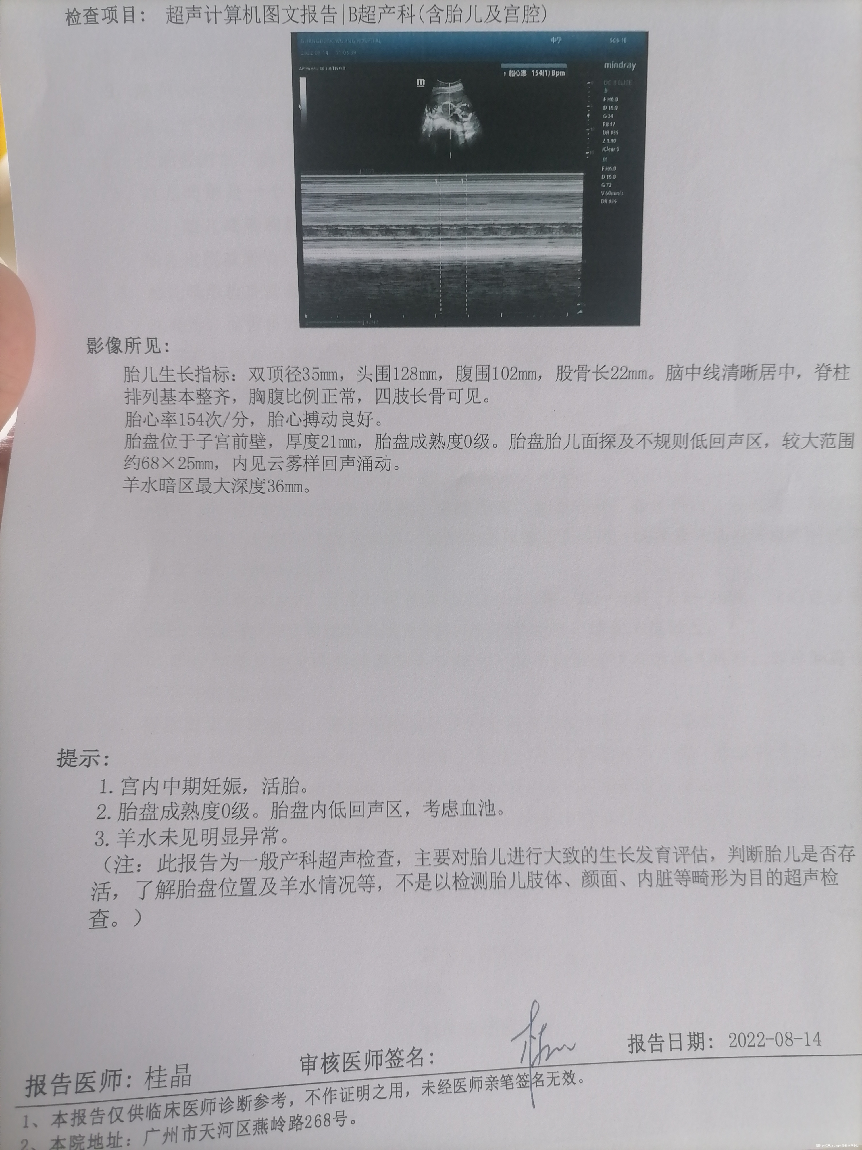 主任这会导致胎停吗才16+